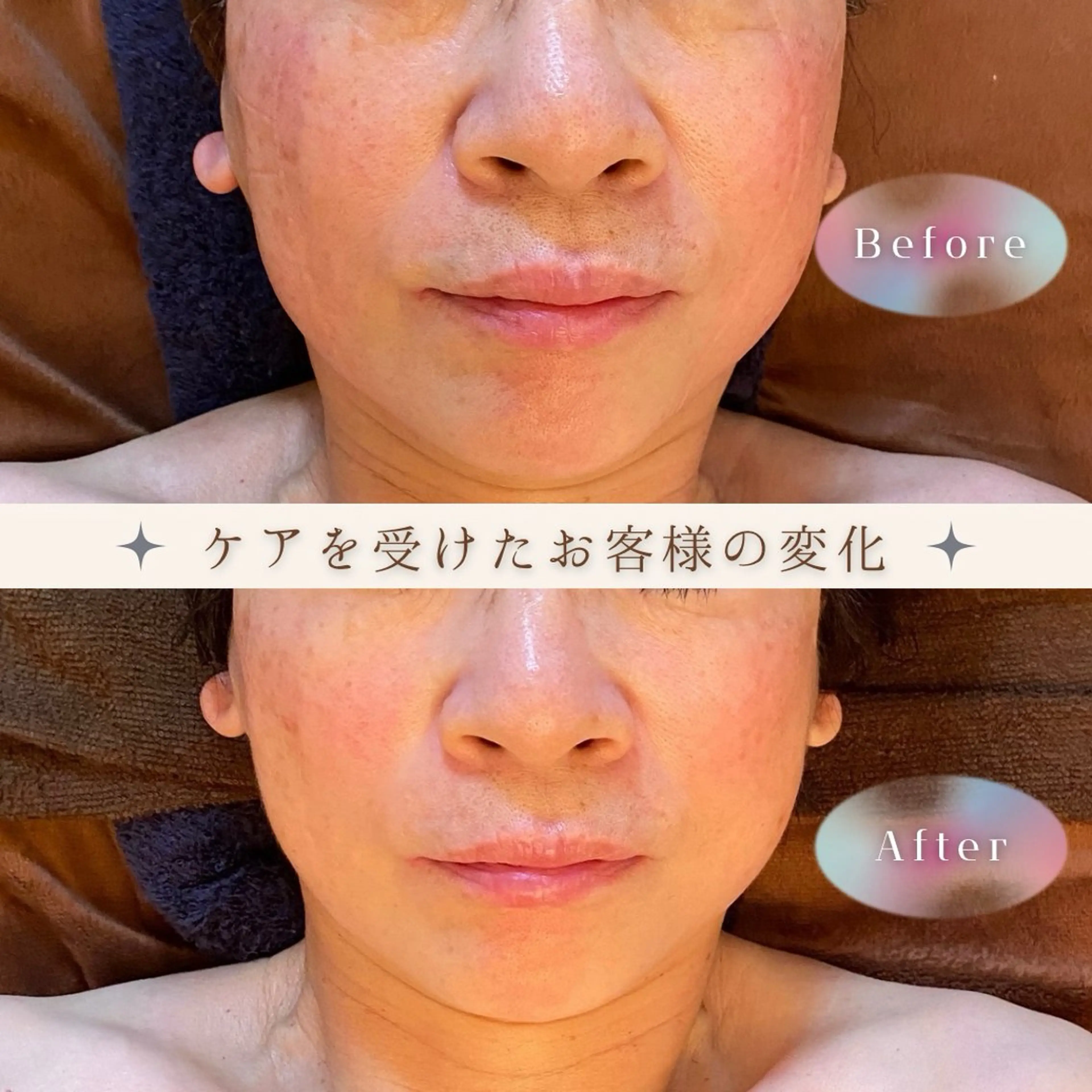 Nao Fukuoka/healingforceN所属・野中 康子のエステ・リラクイメージ