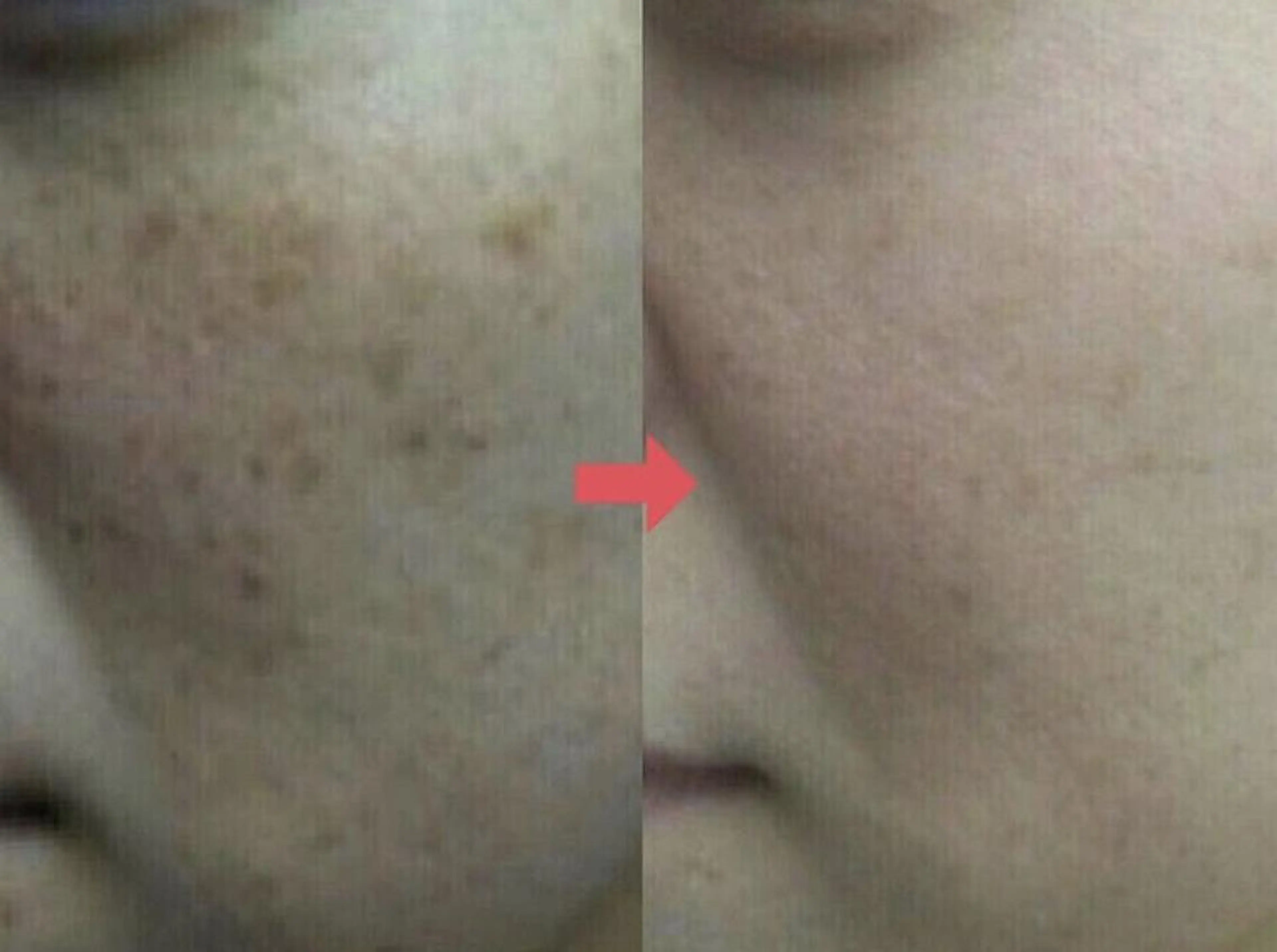 横浜エステサロン R-ing リングのエステ・リラクイメージ