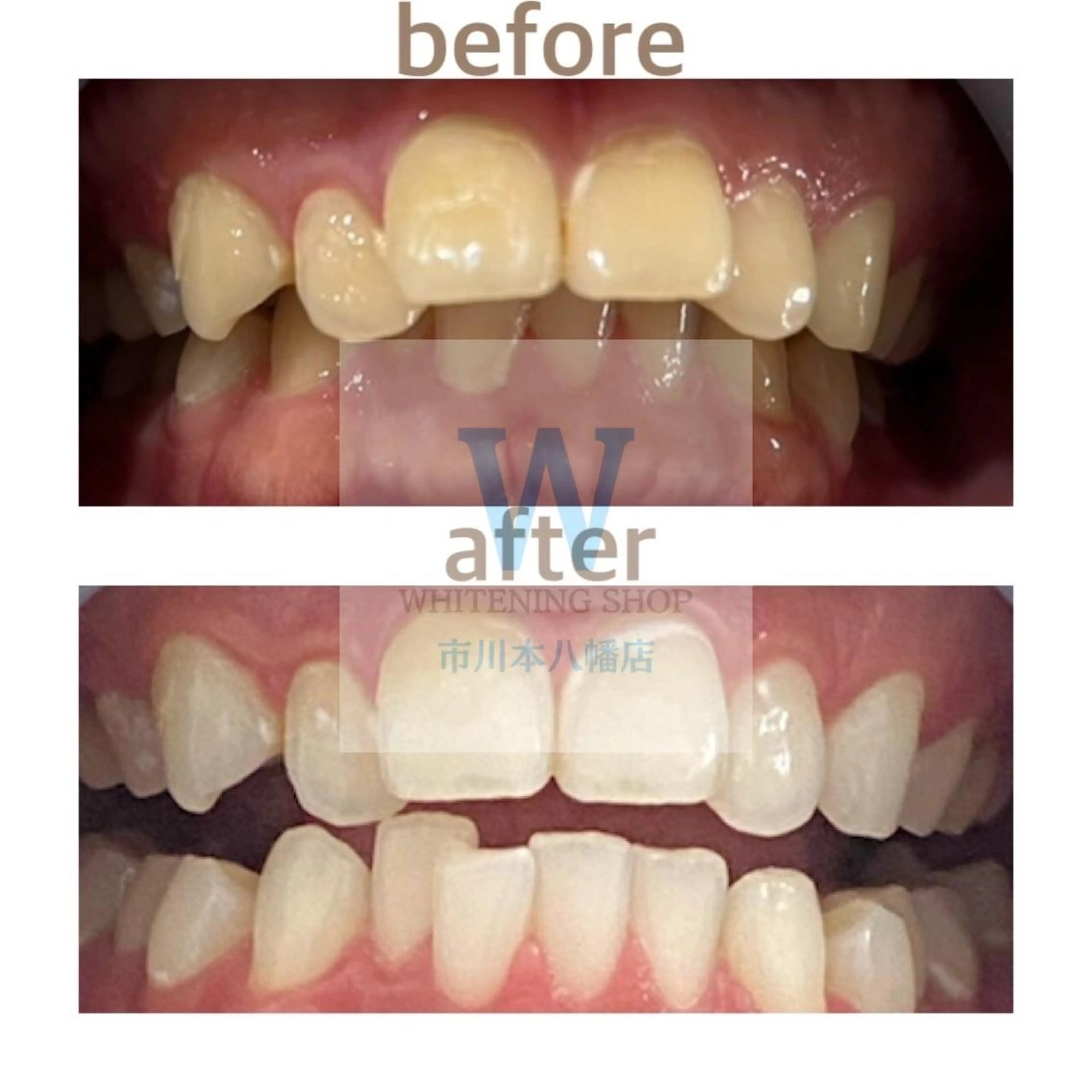 ホワイトニング ショップ本八幡店のエステ・リラクイメージ