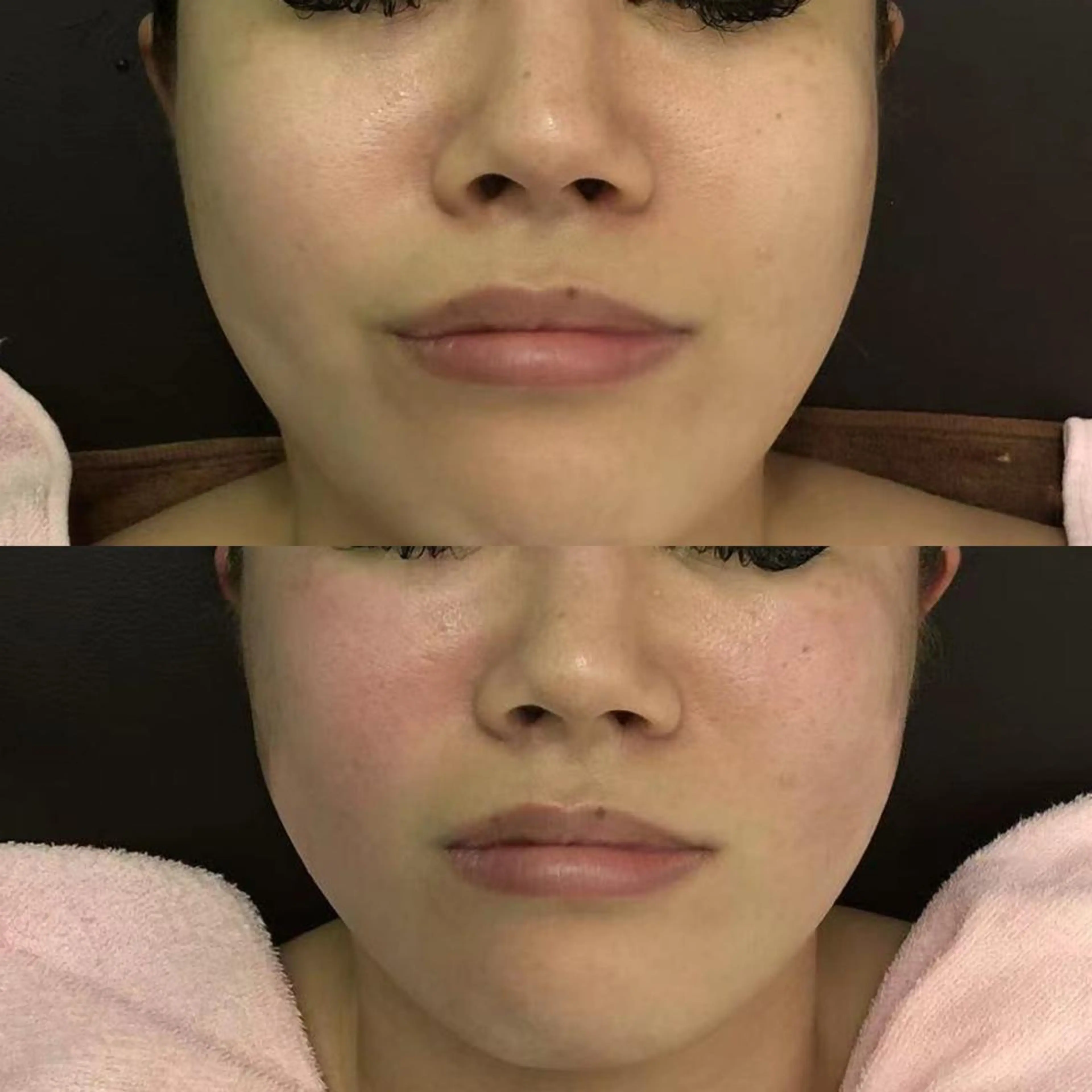 【ハイパーナイフ痩身&小顔コルギ&ハーブピーリング】K-Beauty　東新宿所属・kーbeauty小顔 コルギ&インディバのエステ・リラクイメージ