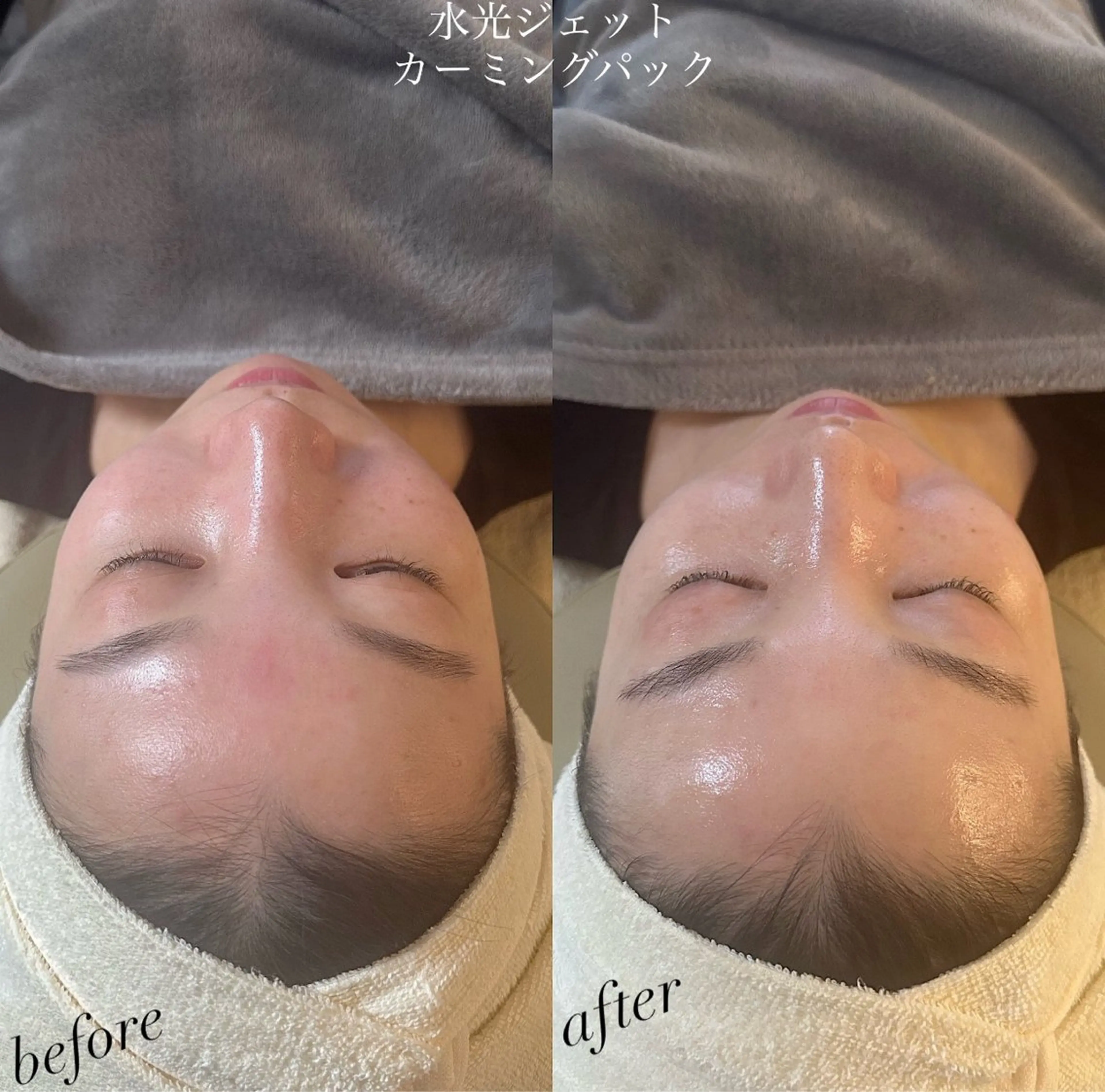 うなじ脱毛/美肌脱毛 LABELのエステ・リラクイメージ