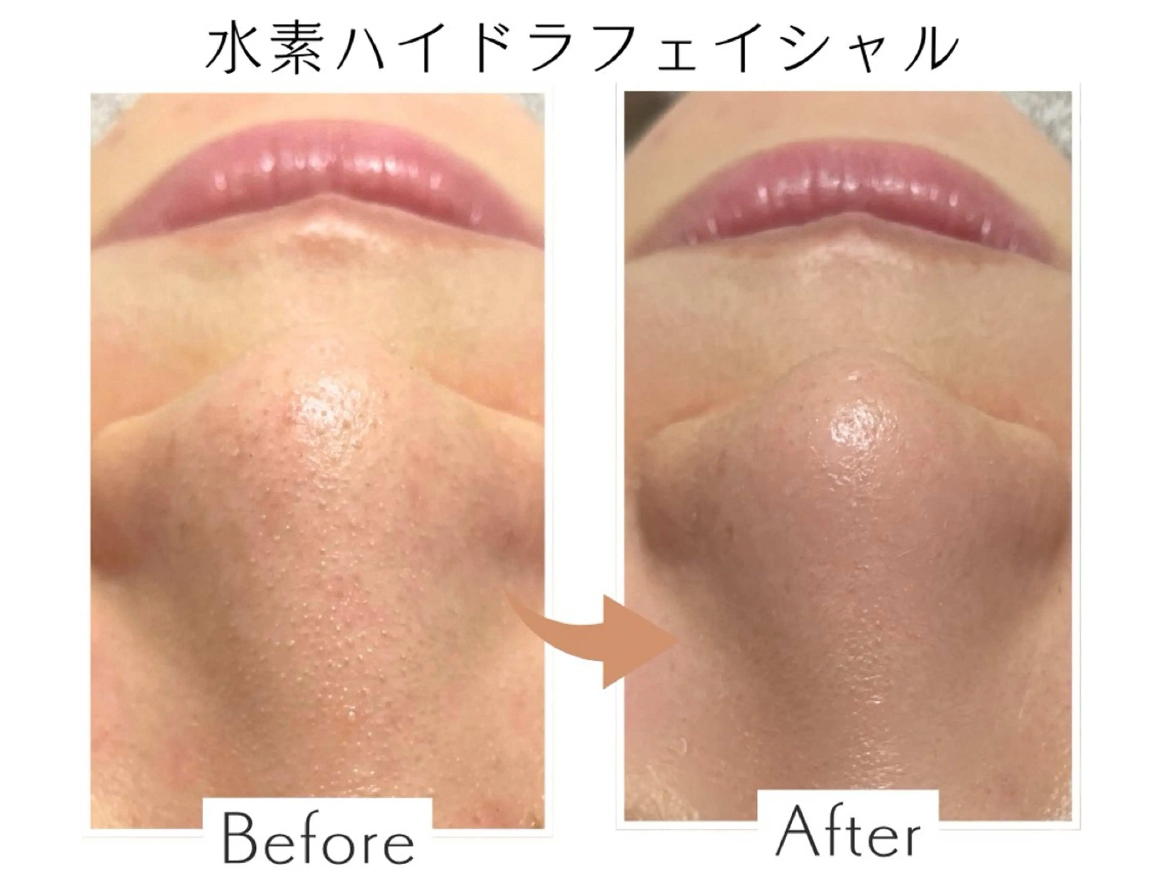 エステ リラク プライベートサロン Belle(ベル)のエステ・リラクイメージ