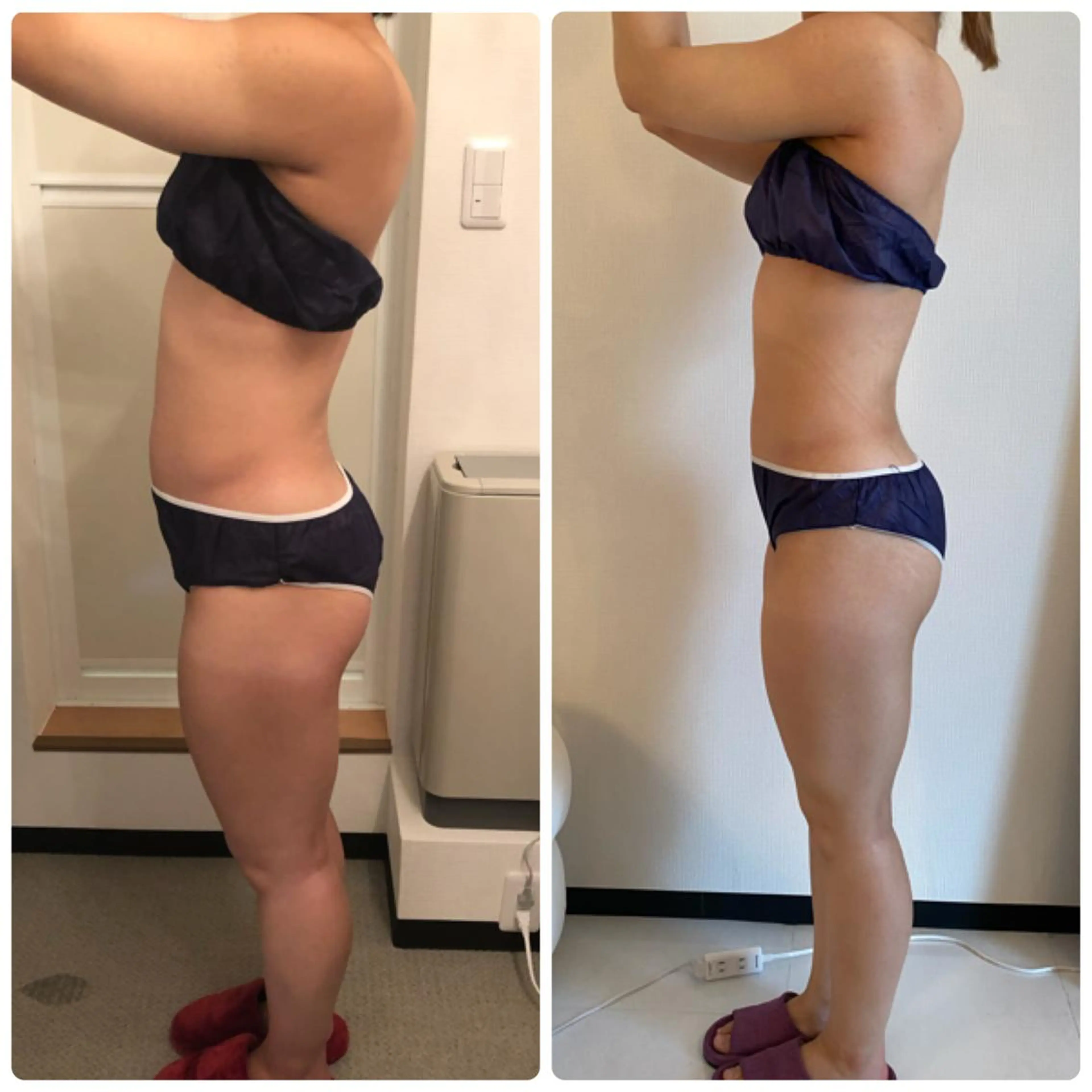 FLEUR大阪・整体 ・ハイフ・痩身・小顔のエステ・リラクイメージ