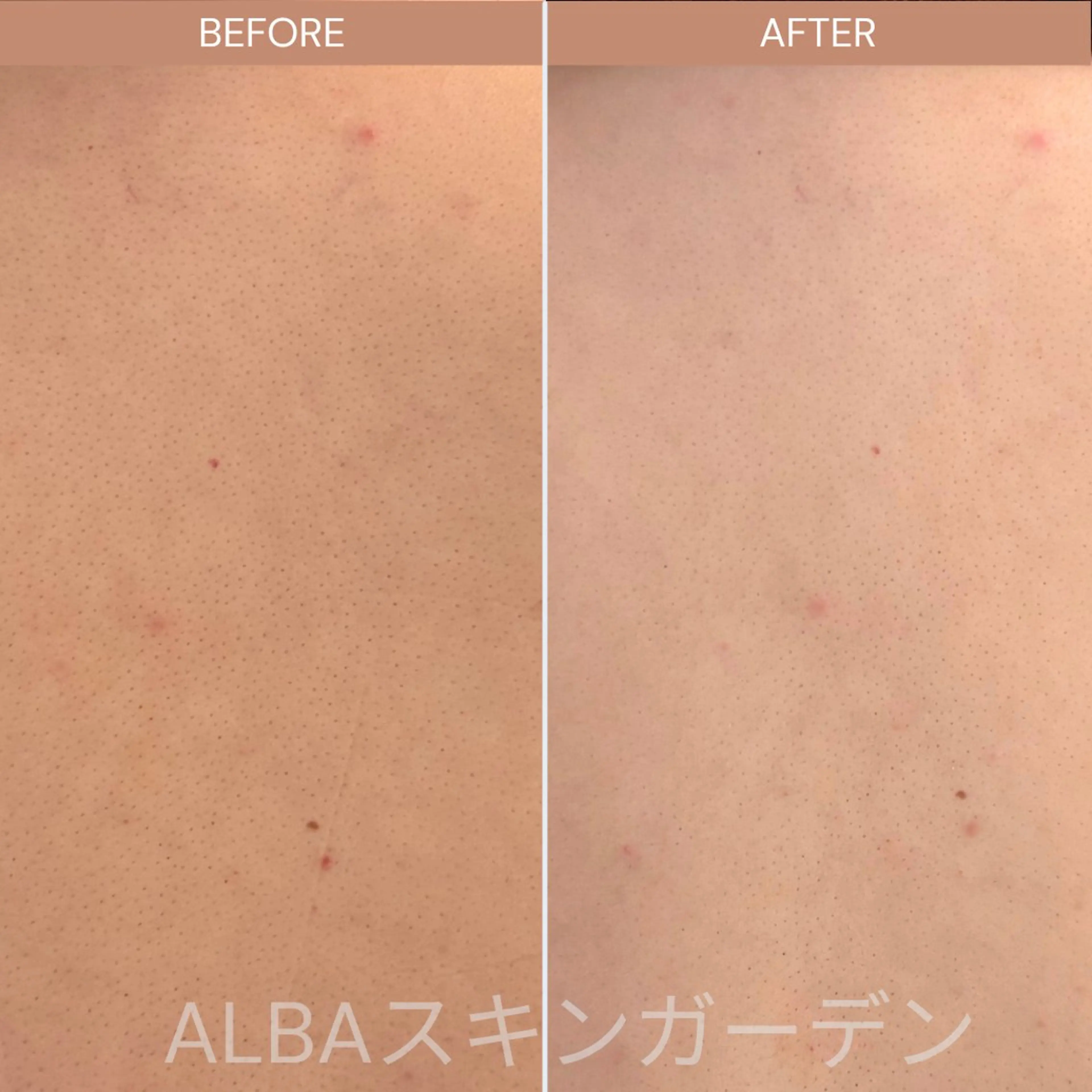 ALBAスキンガーデン所属・ALBA🌱 yuriのエステ・リラクイメージ