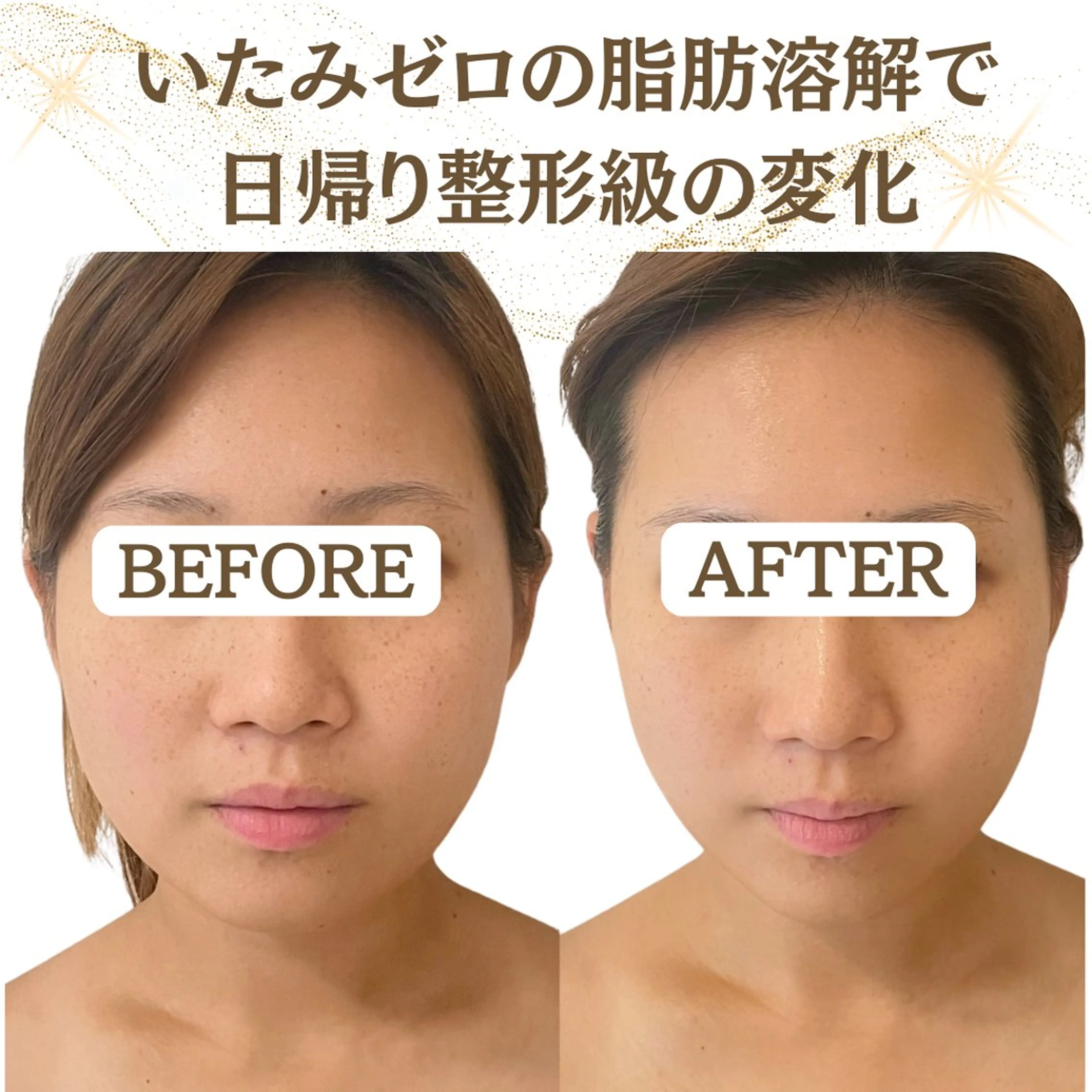 エステ 小顔/たるみ/黒ずみ除去専門サロン/SONA 大和西大寺店所属・【小顔専門看護師 サロンSONA】のエステ・リラクイメージ