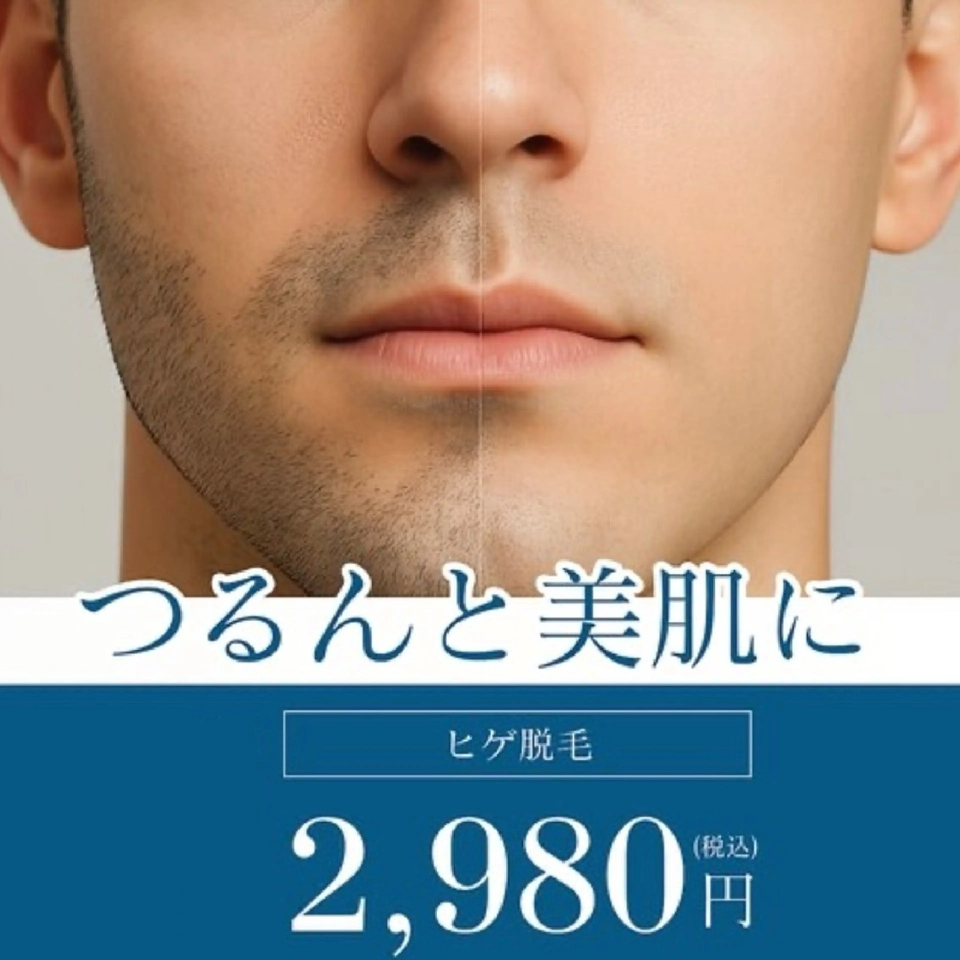 【男性限定】ヒゲ脱毛の写真