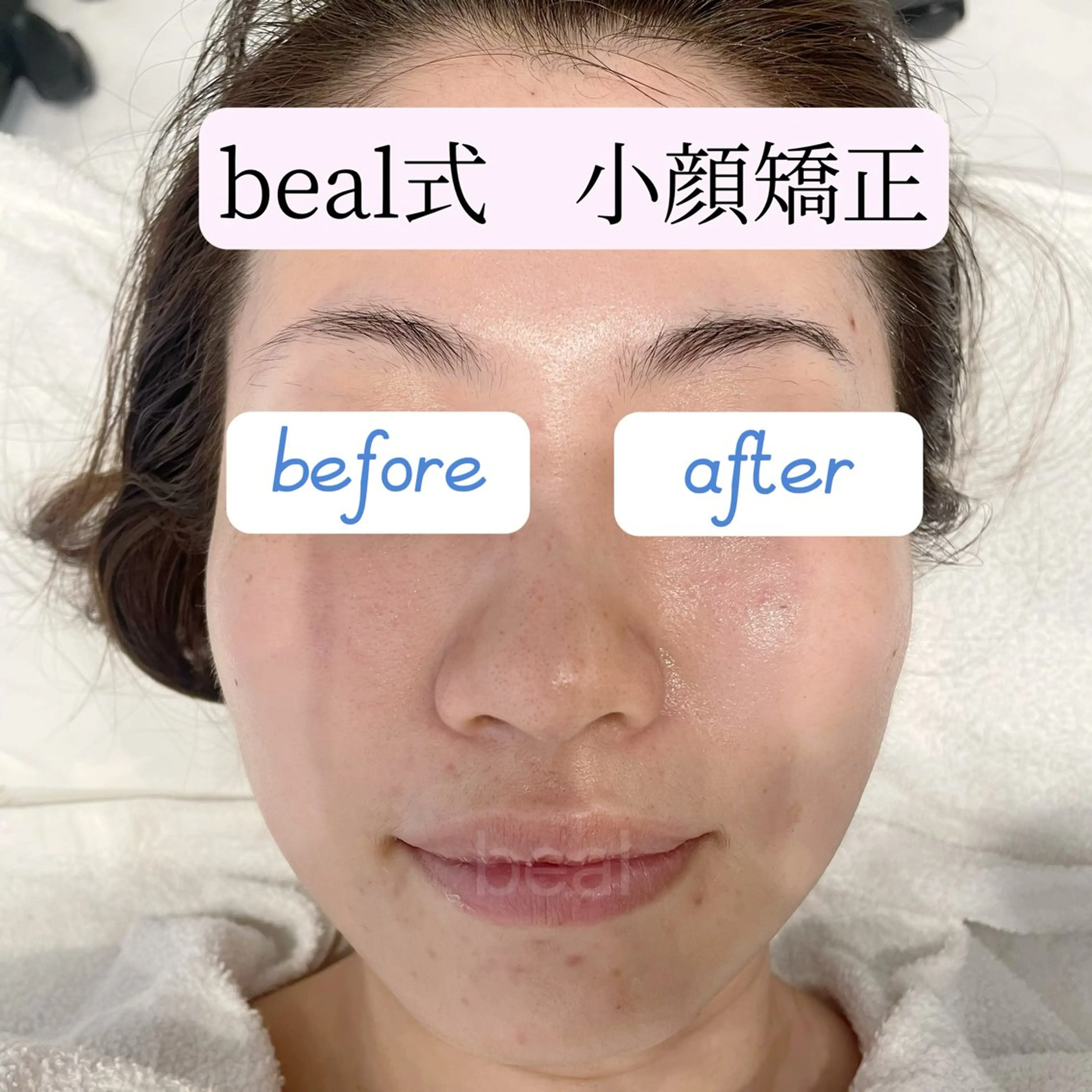 べアール所属・小顔/毛穴/白玉肌 salon bealのその他イメージ