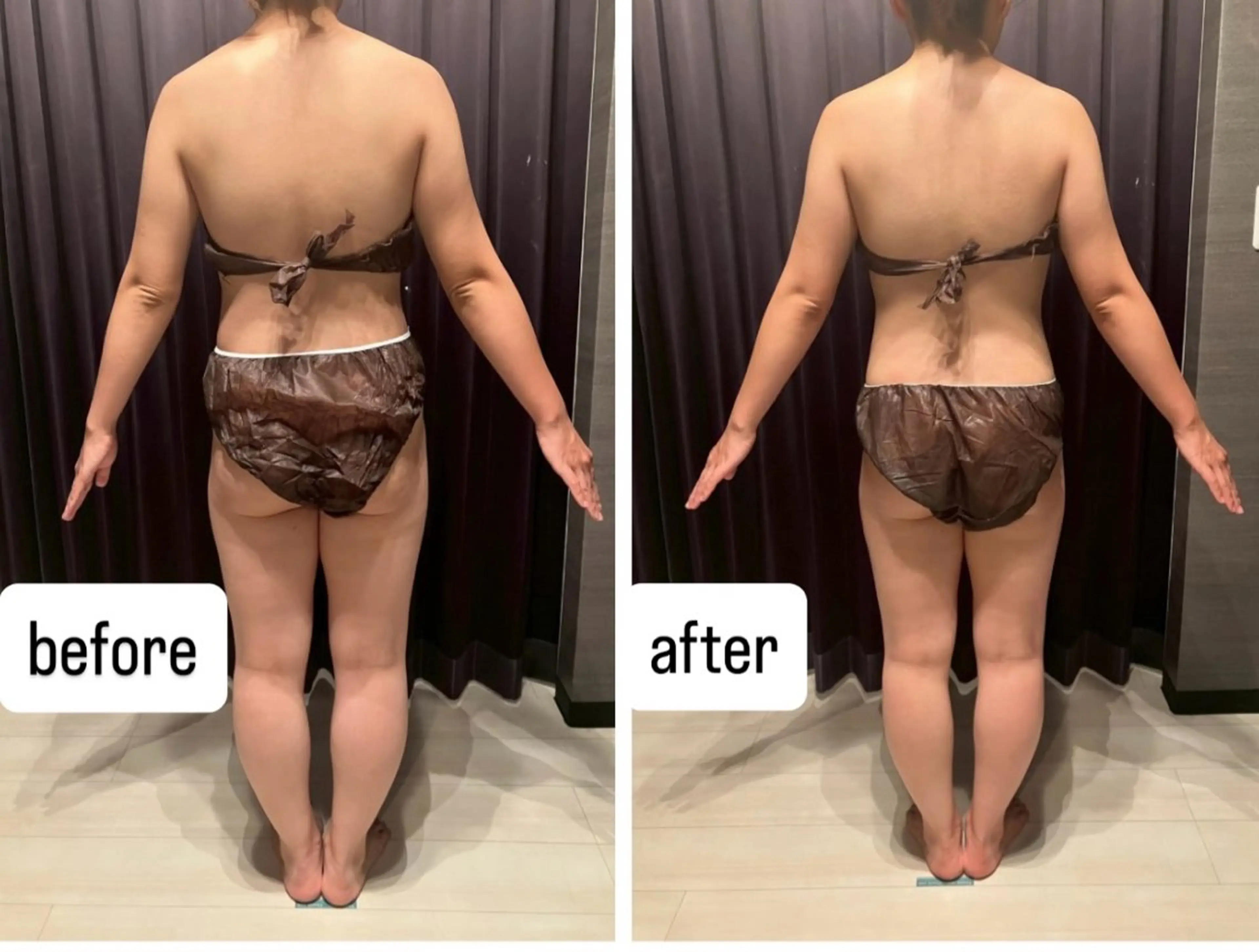 【全身エステメインの小顔マッサージとプチ整体付き】90分¥12980¥→¥7980の写真