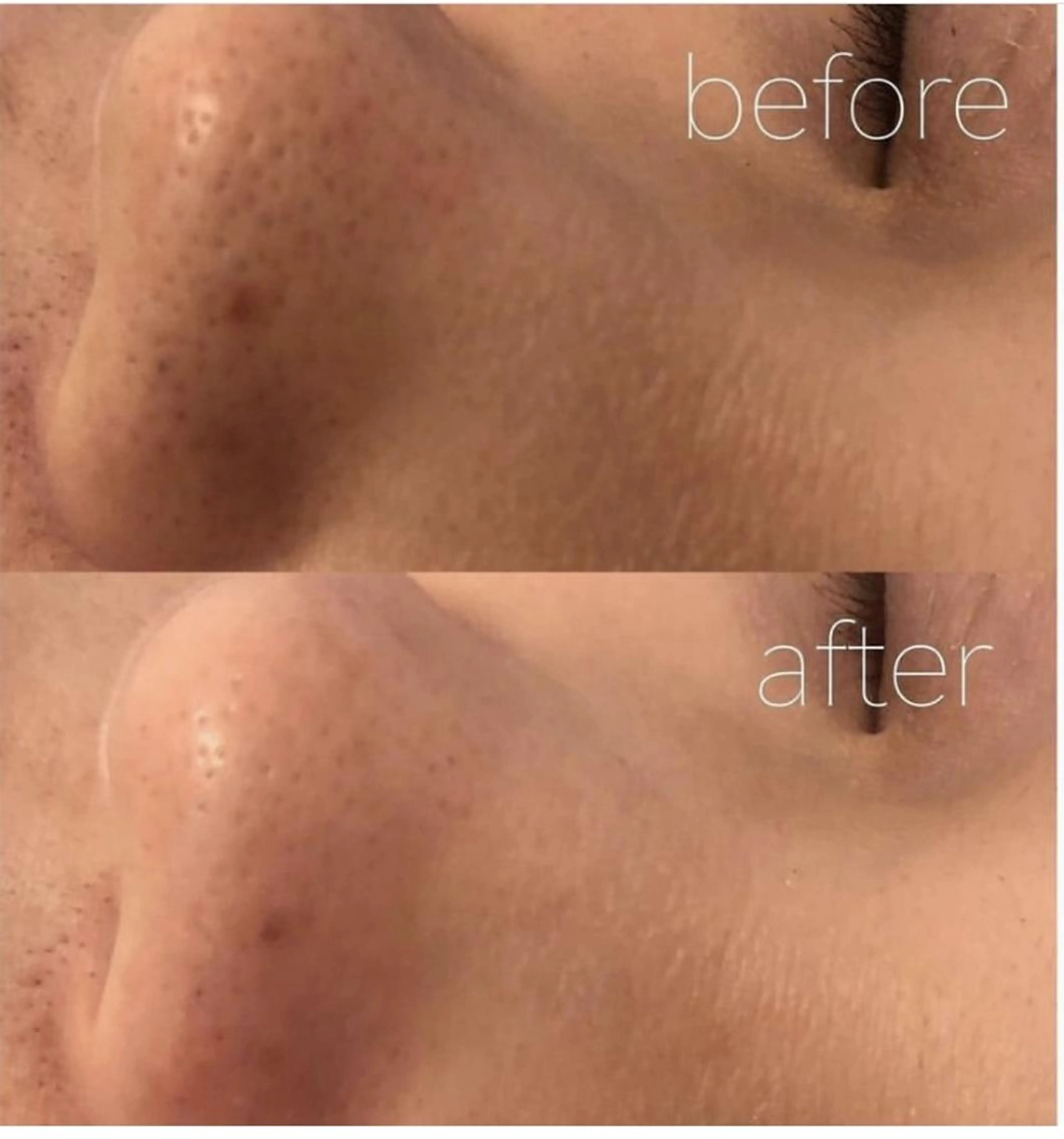 エステ ✨美肌水光✨ アトリエリュバンのエステ・リラクイメージ