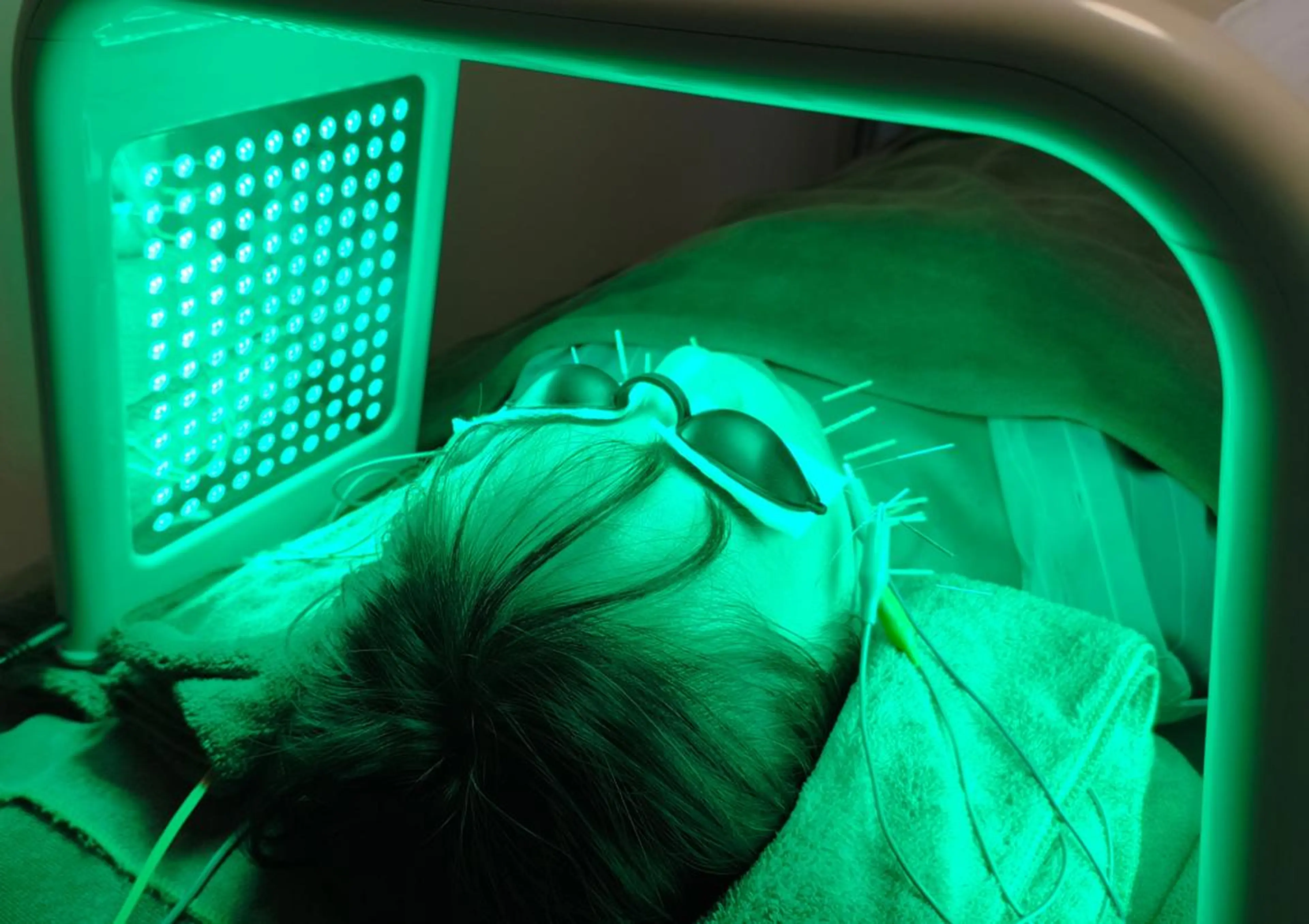 美容とカラダの鍼灸 サロン やなけんのエステ・リラクイメージ