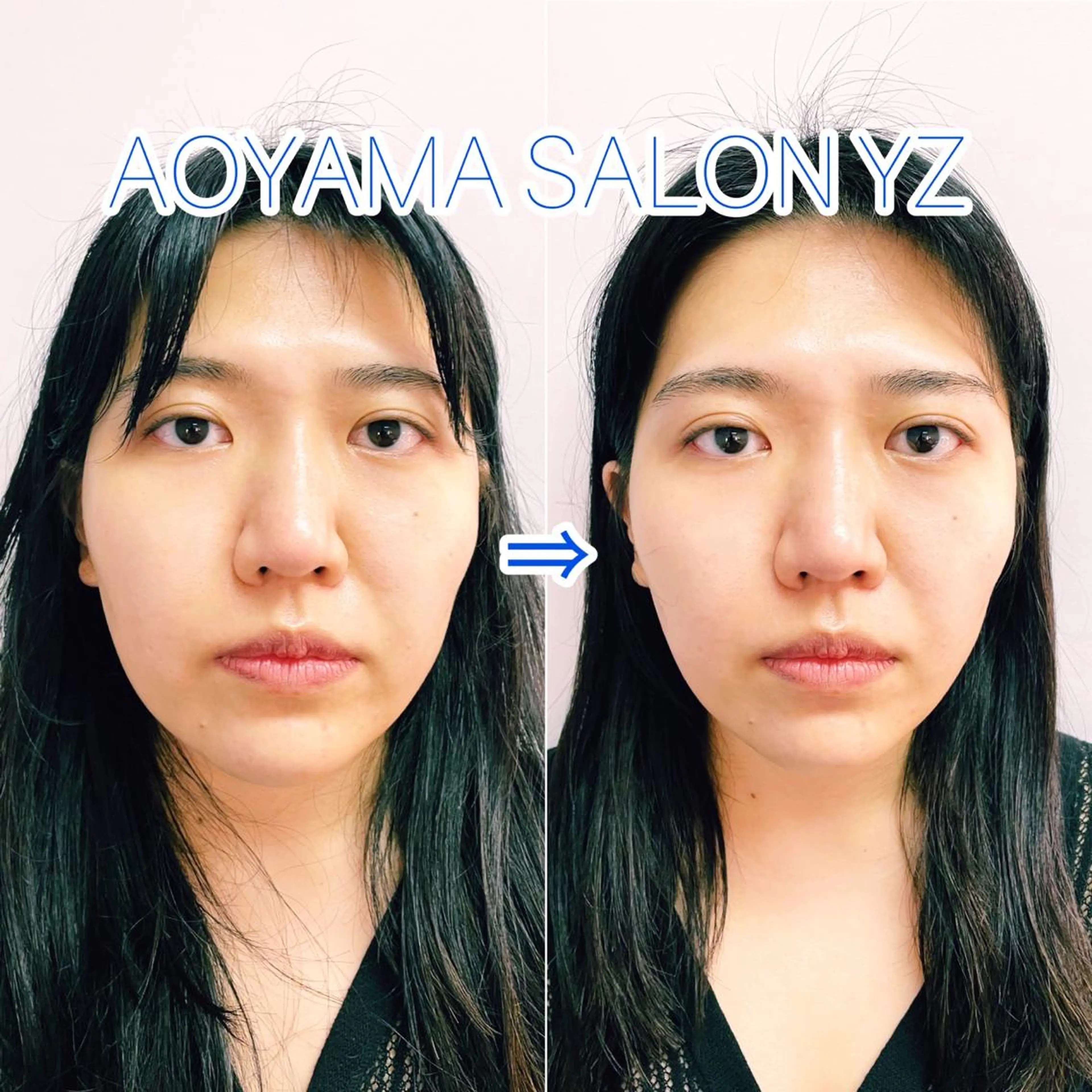 小顔美容鍼専門サロン 渋谷YZのエステ・リラクイメージ