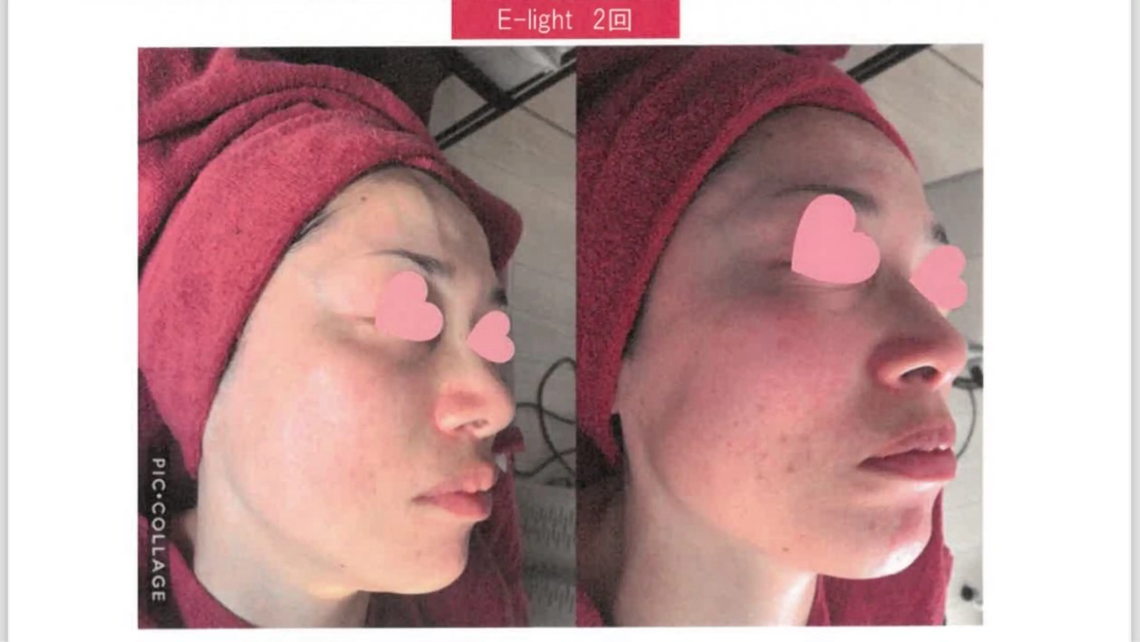 エステ リラク private salon meのエステ・リラクイメージ