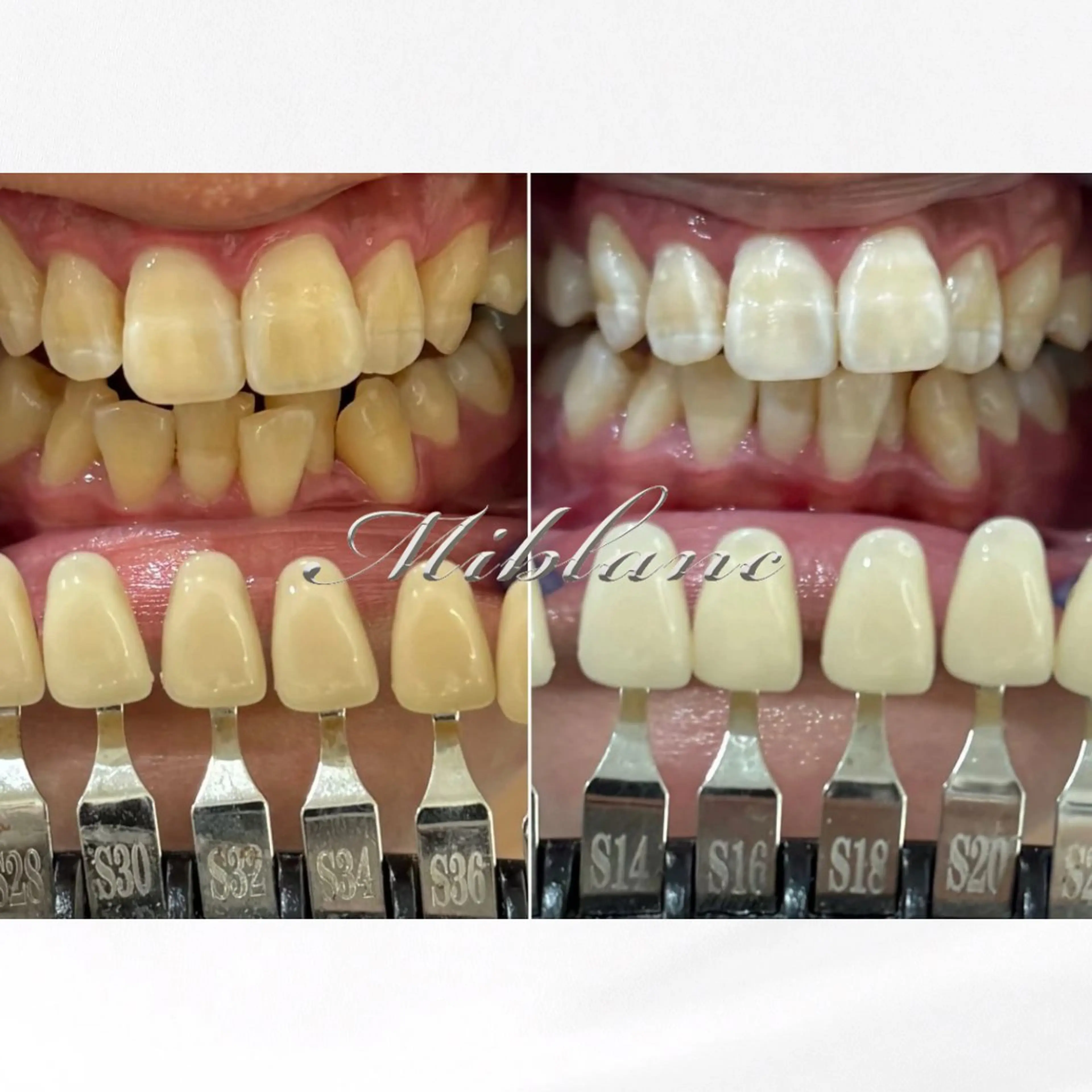 ホワイトニング MIBLANC上野店のその他イメージ