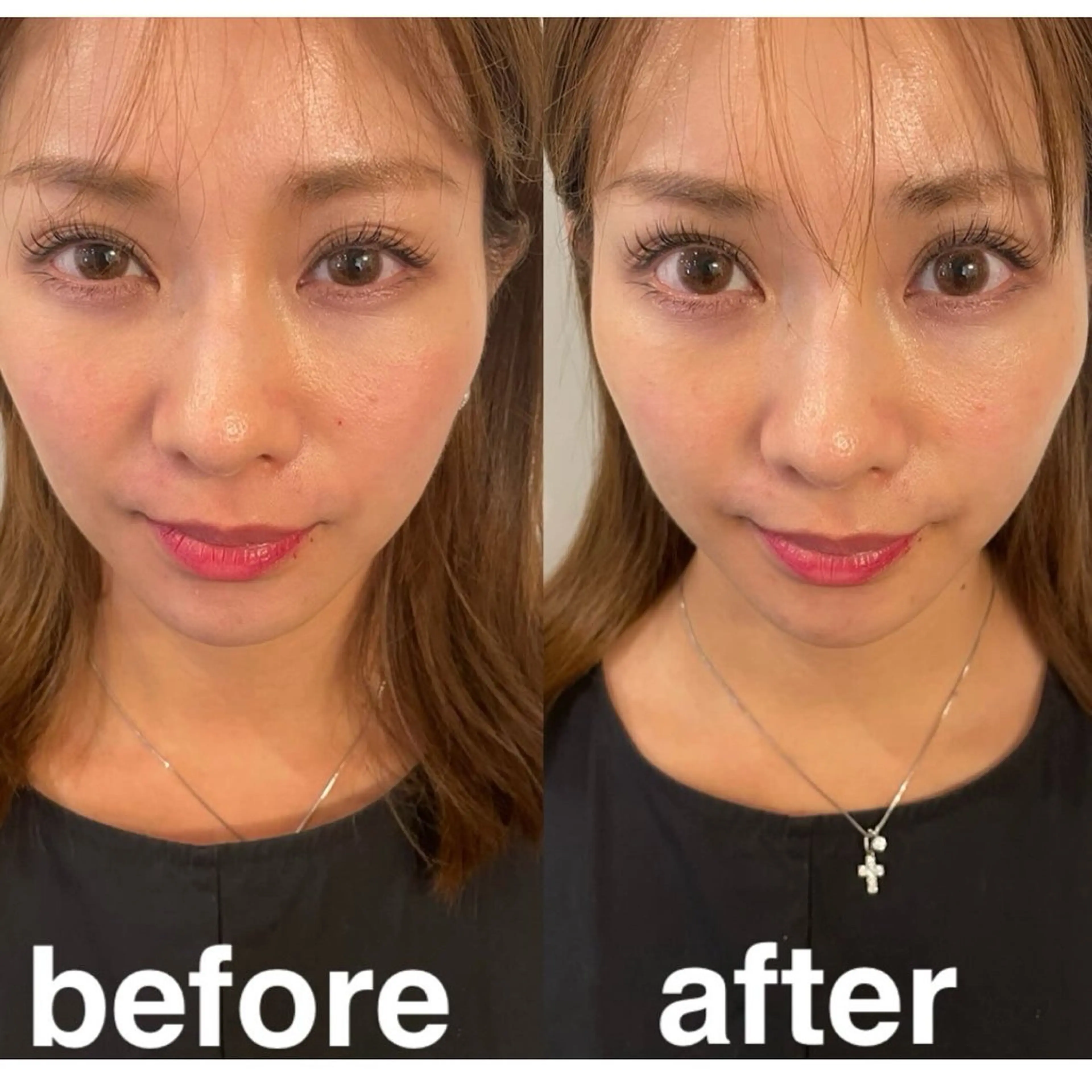 美容鍼灸サロン mahoroba院長のエステ・リラクイメージ