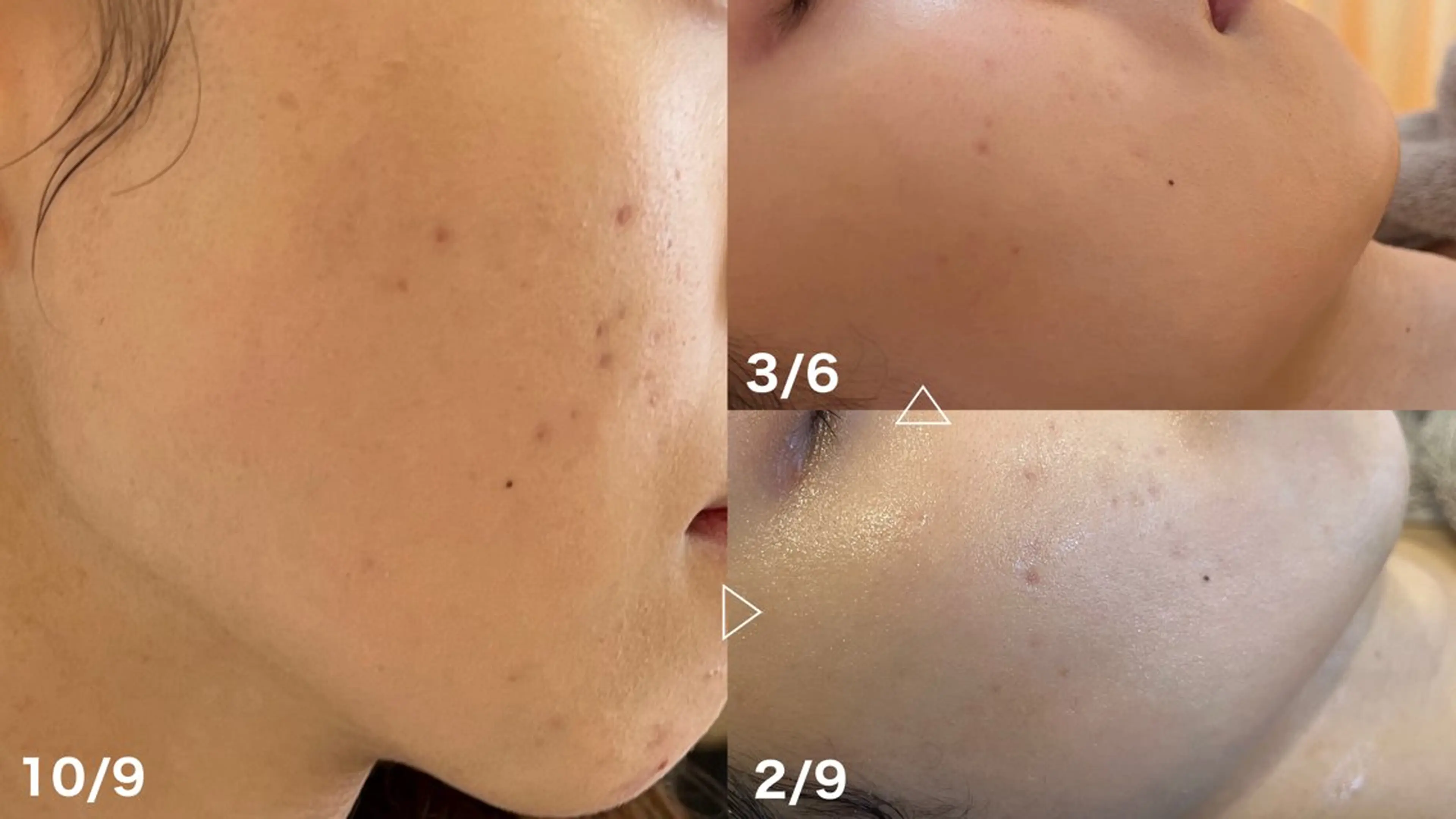 肌質改善サロン🌕 ⠀【ルーナピエナ】のエステ・リラクイメージ