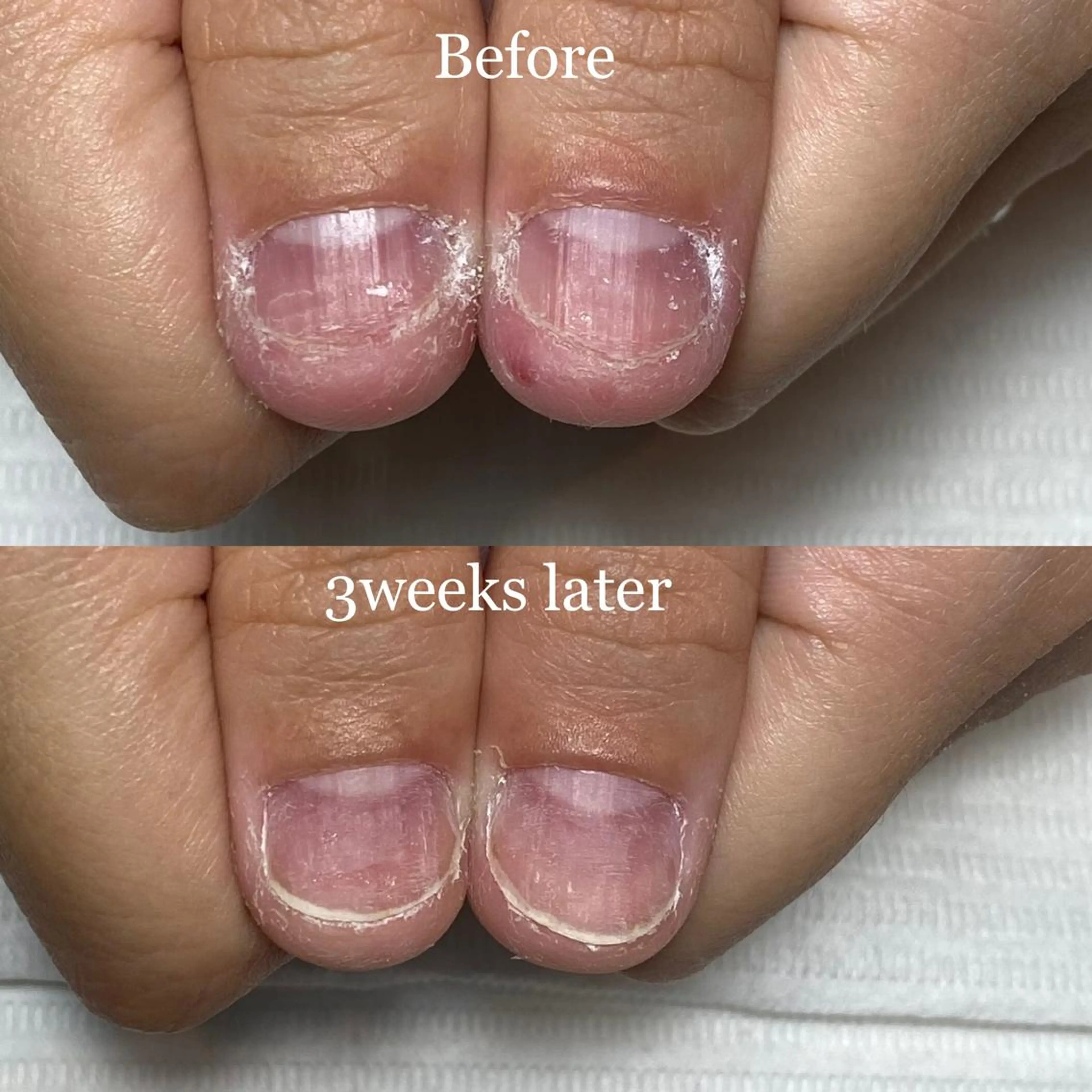 ネイル 長さ出し ジェルネイル 〜Nail Tailor〜　ネイルテイラー所属・NailTailor ネイルテイラーのネイルデザイン