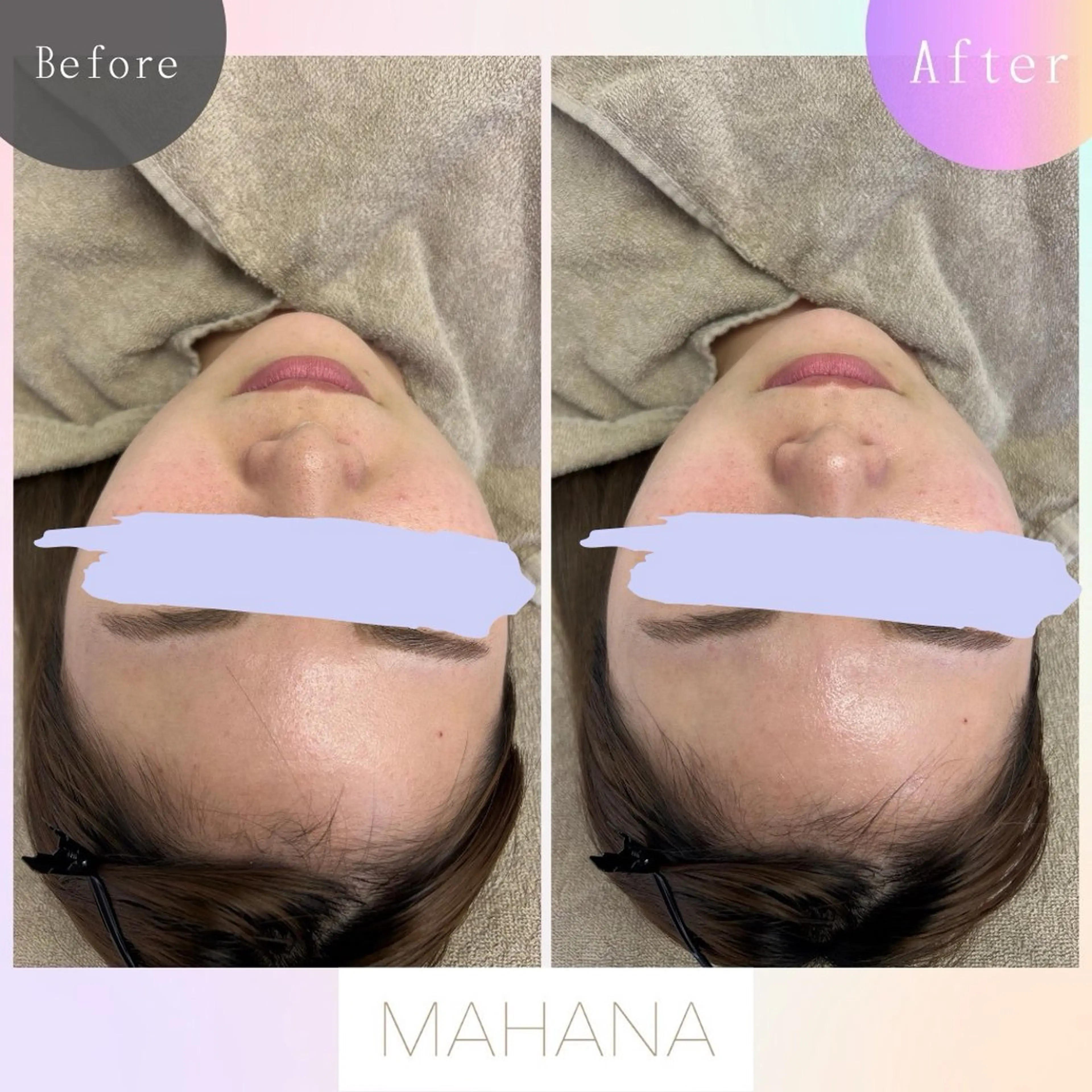 MAHANA 耳ツボ/毛穴洗浄のエステ・リラクイメージ
