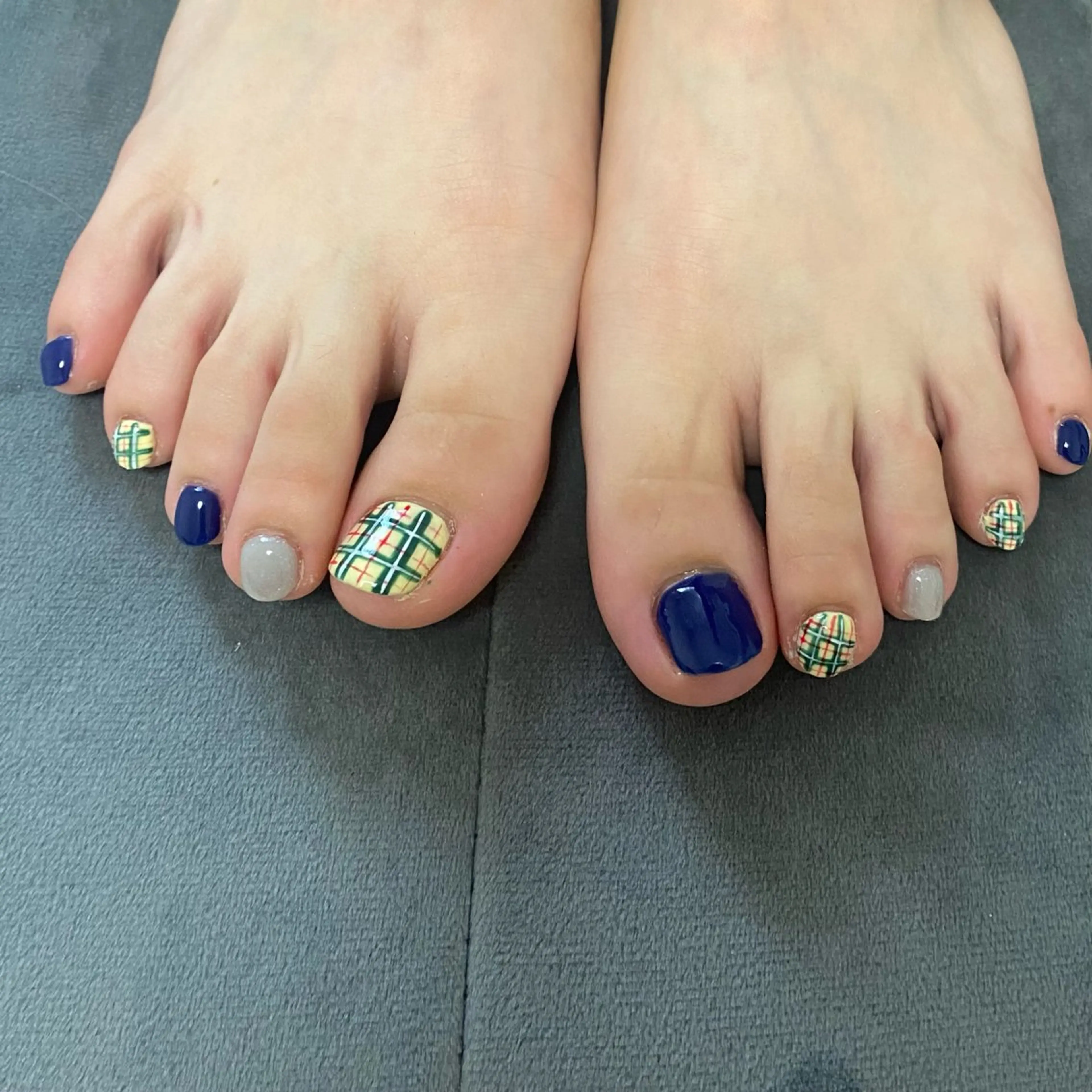 フットネイルデザインの写真