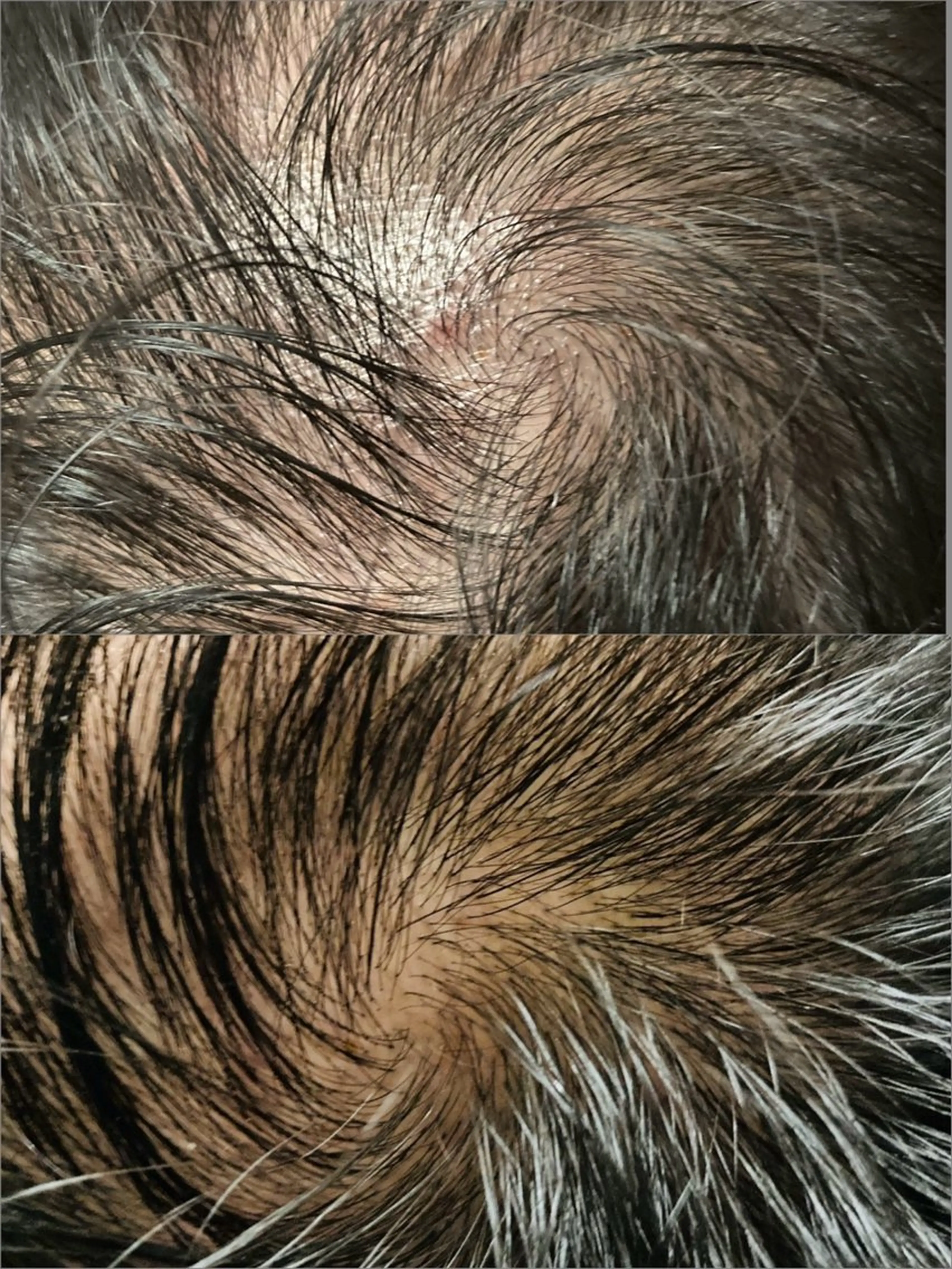 エステ LiZA エステティックサロンのエステ・リラクイメージ