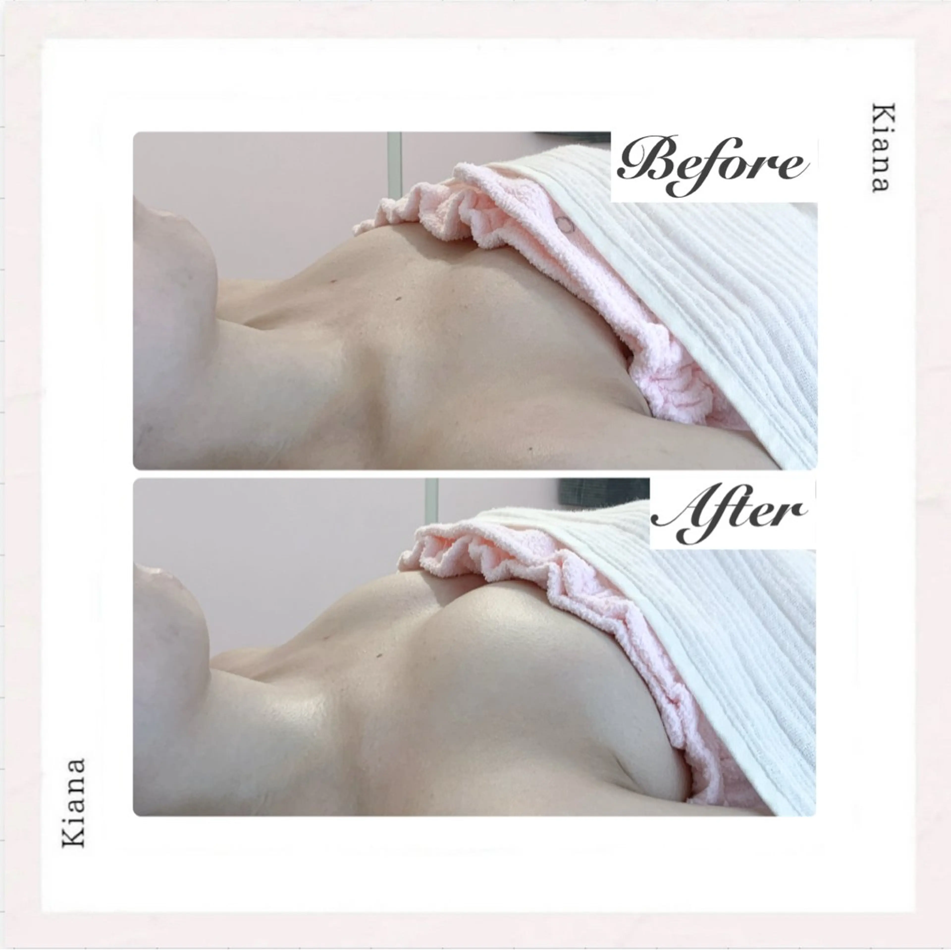 エステ リラク バスト専門Kiana 風のエステ・リラクイメージ