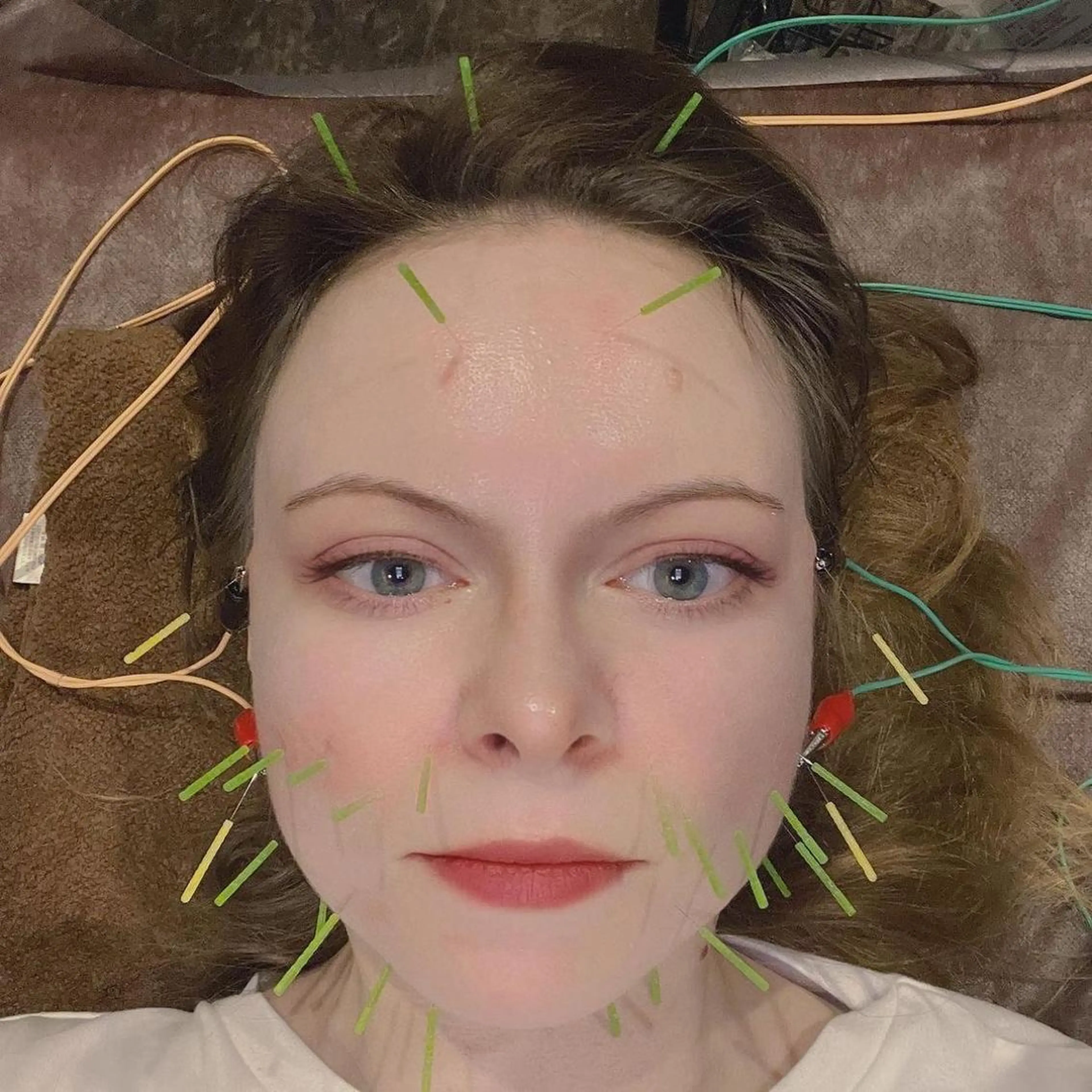 メンズ エステ リラク 美容鍼灸サロン LOMIHARIのエステ・リラクイメージ