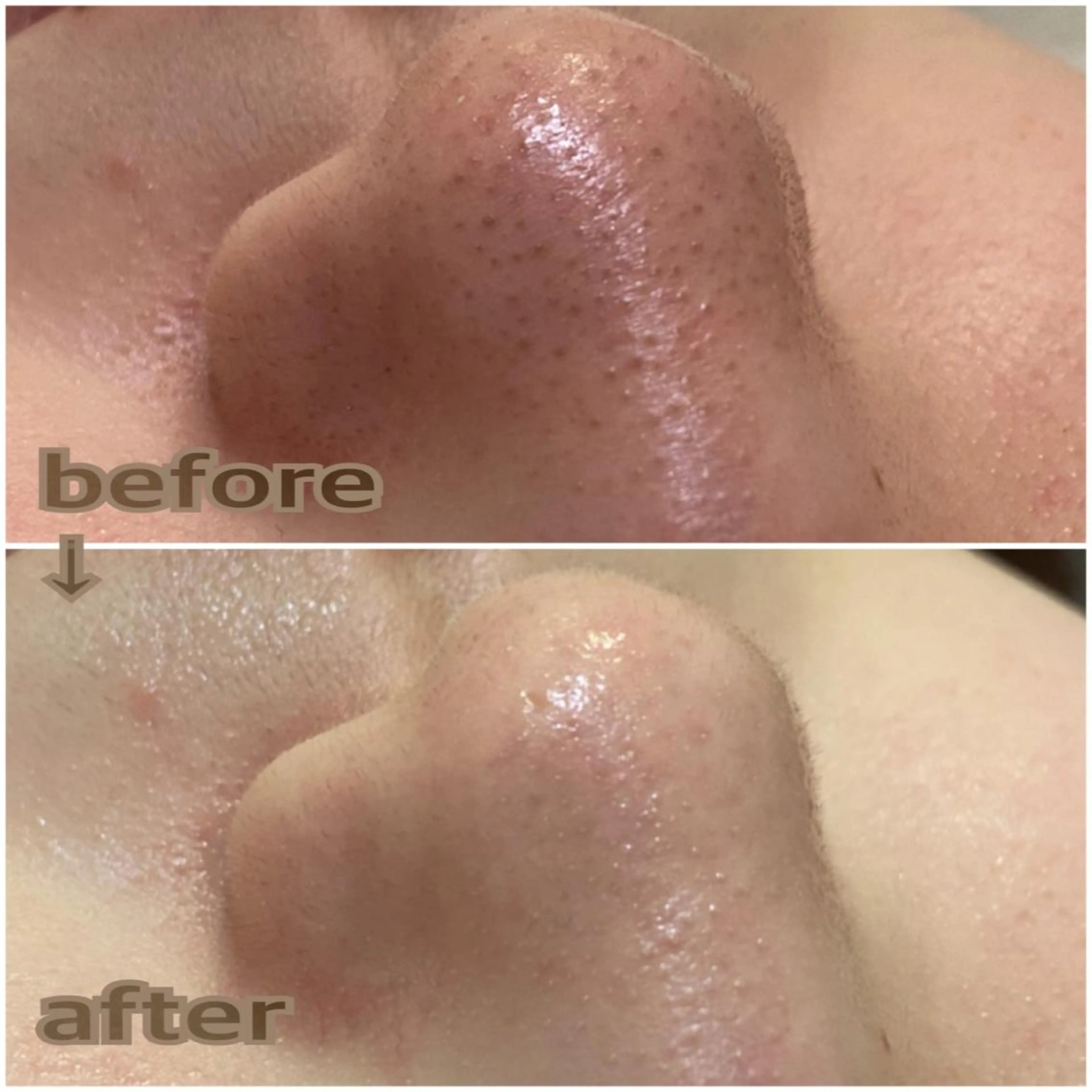 aroma  YURARI所属・韓国艶美人// 毛穴ケア🌹のエステ・リラクイメージ