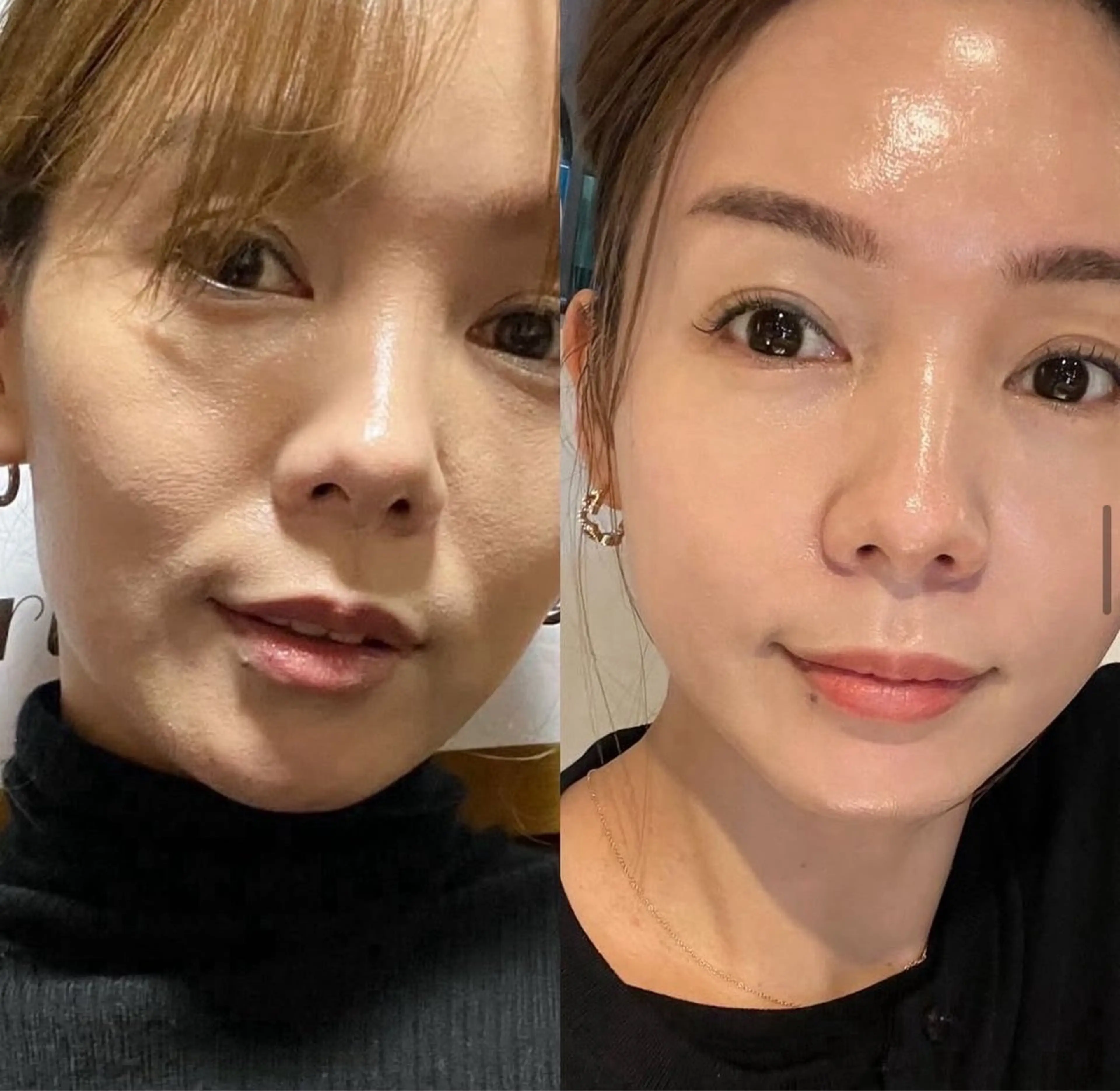 その他 【vidyto】ヴィディトゥ所属・肌管理サロン vidyto　MOEのその他イメージ