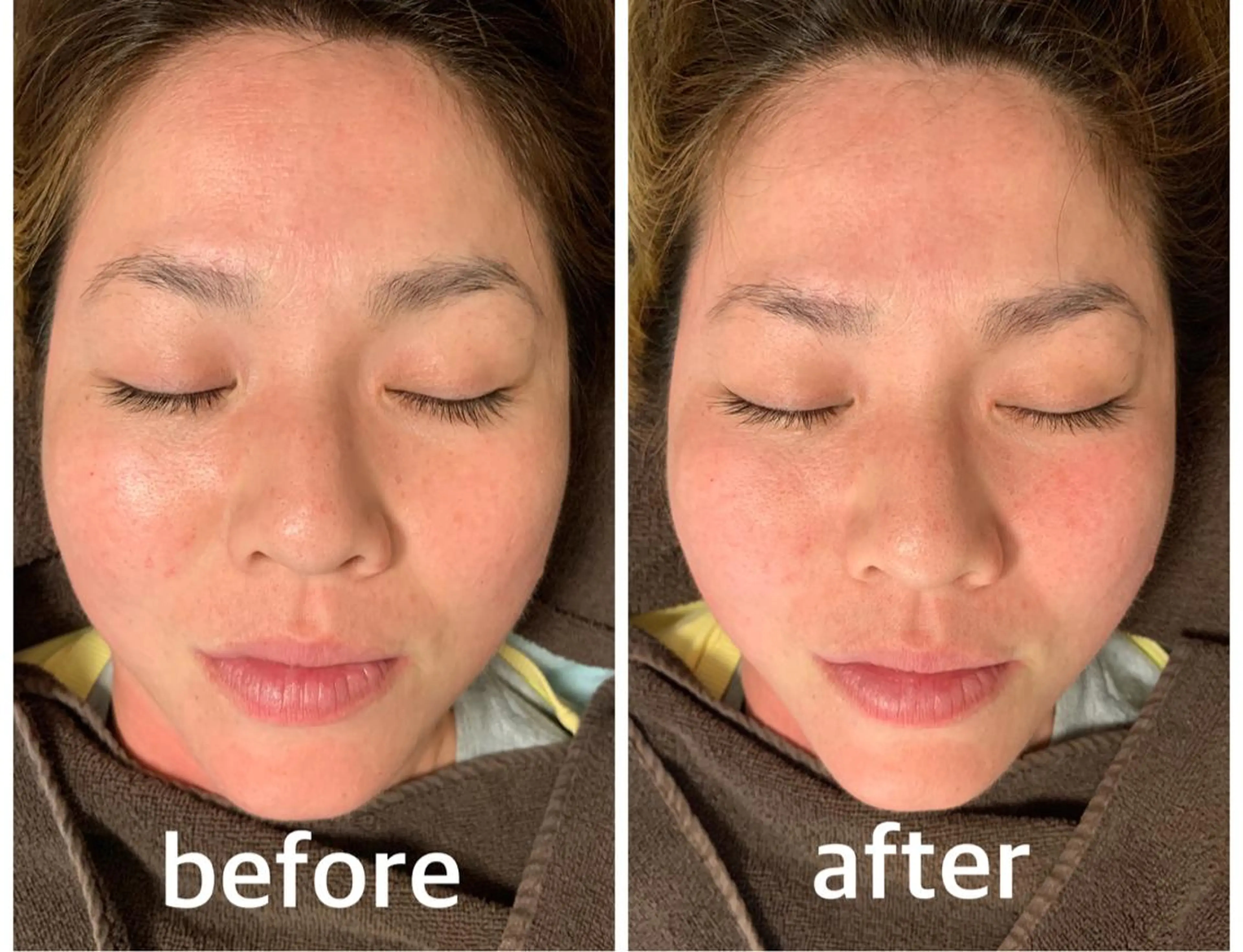 エステ リラク 食べながら魅せボディ éclatJua川越のエステ・リラクイメージ