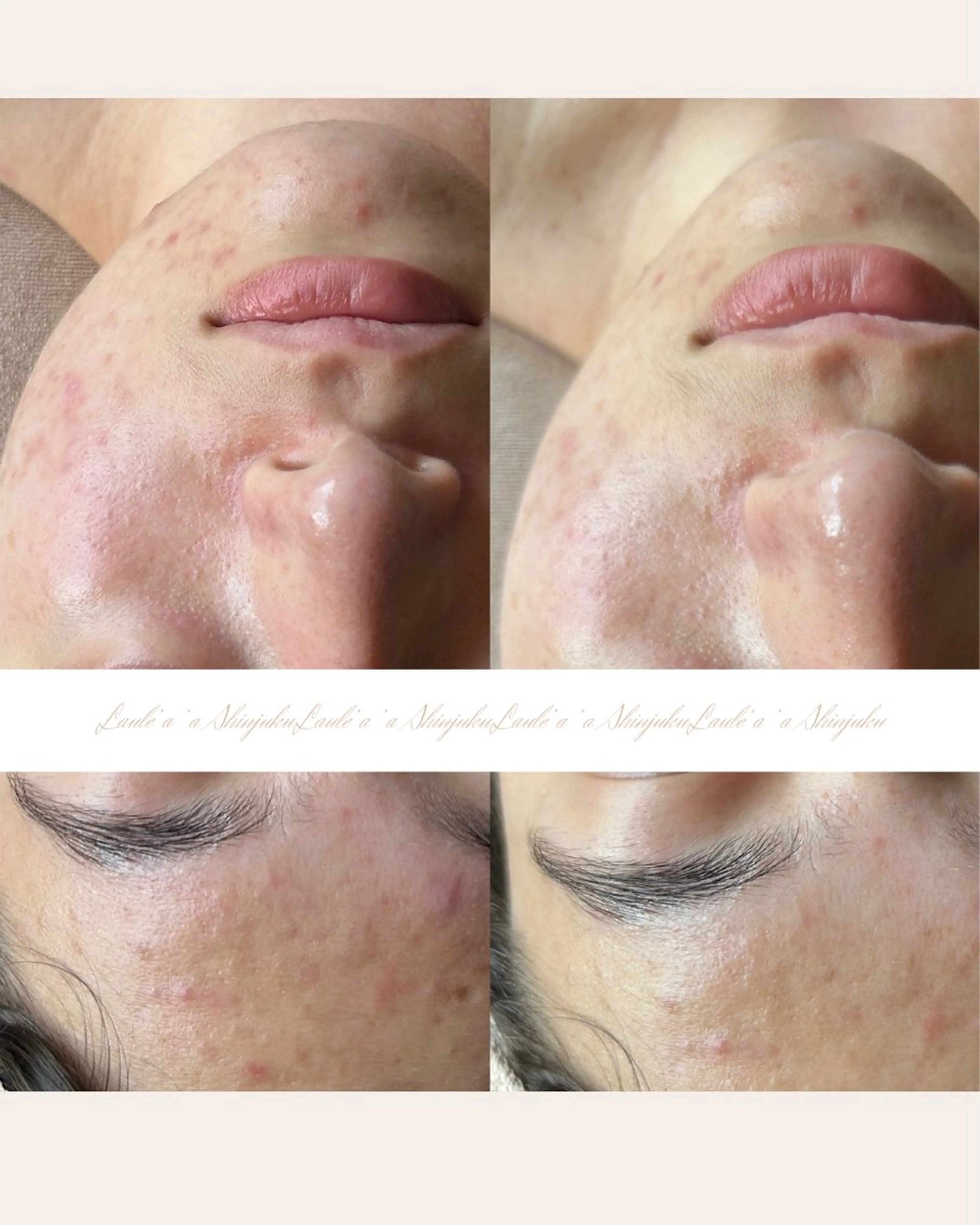 痩身/腸もみ/ ヘッドスパ/リンパのエステ・リラクイメージ