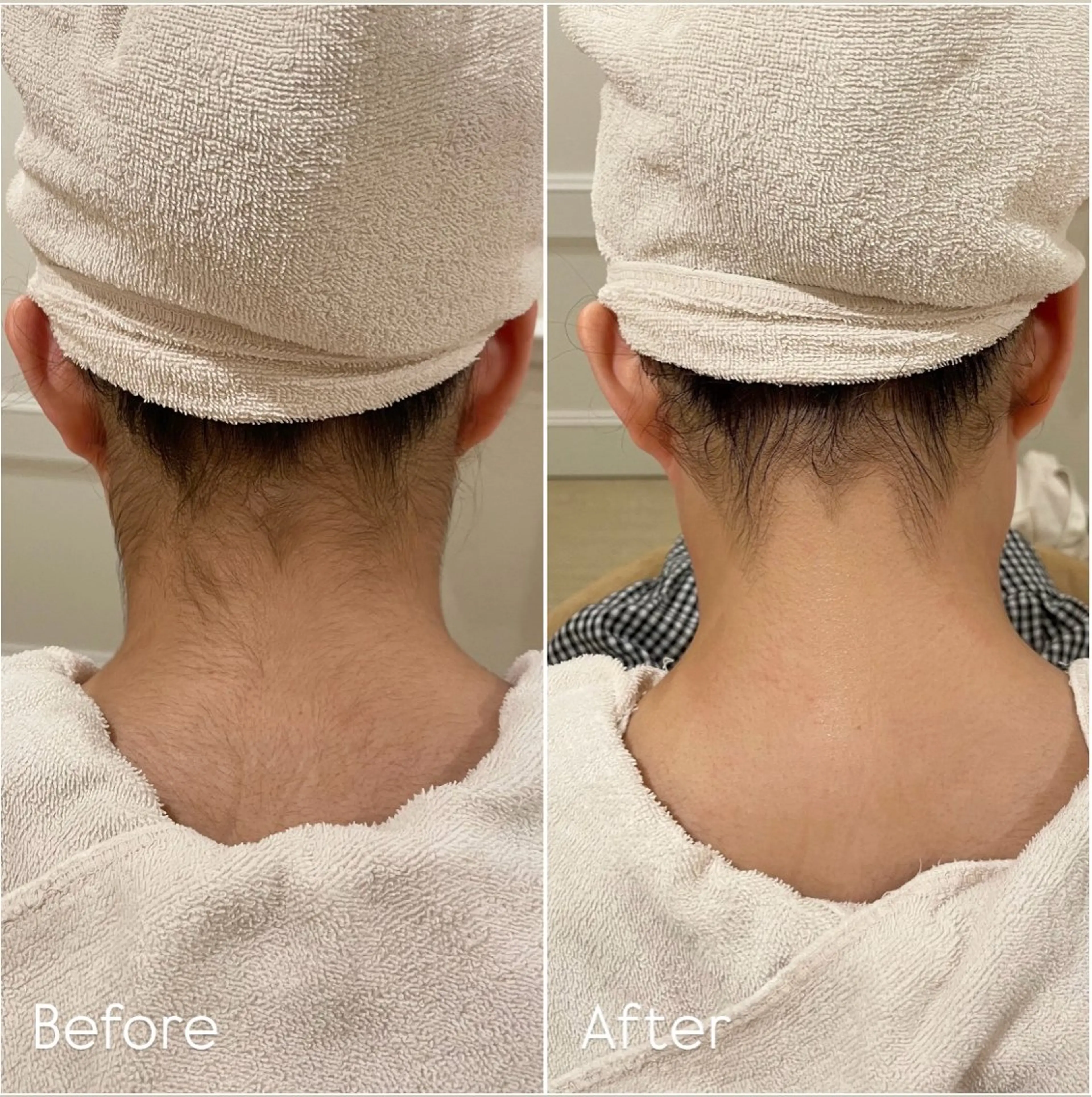 うなじシェービング🪞✨の写真