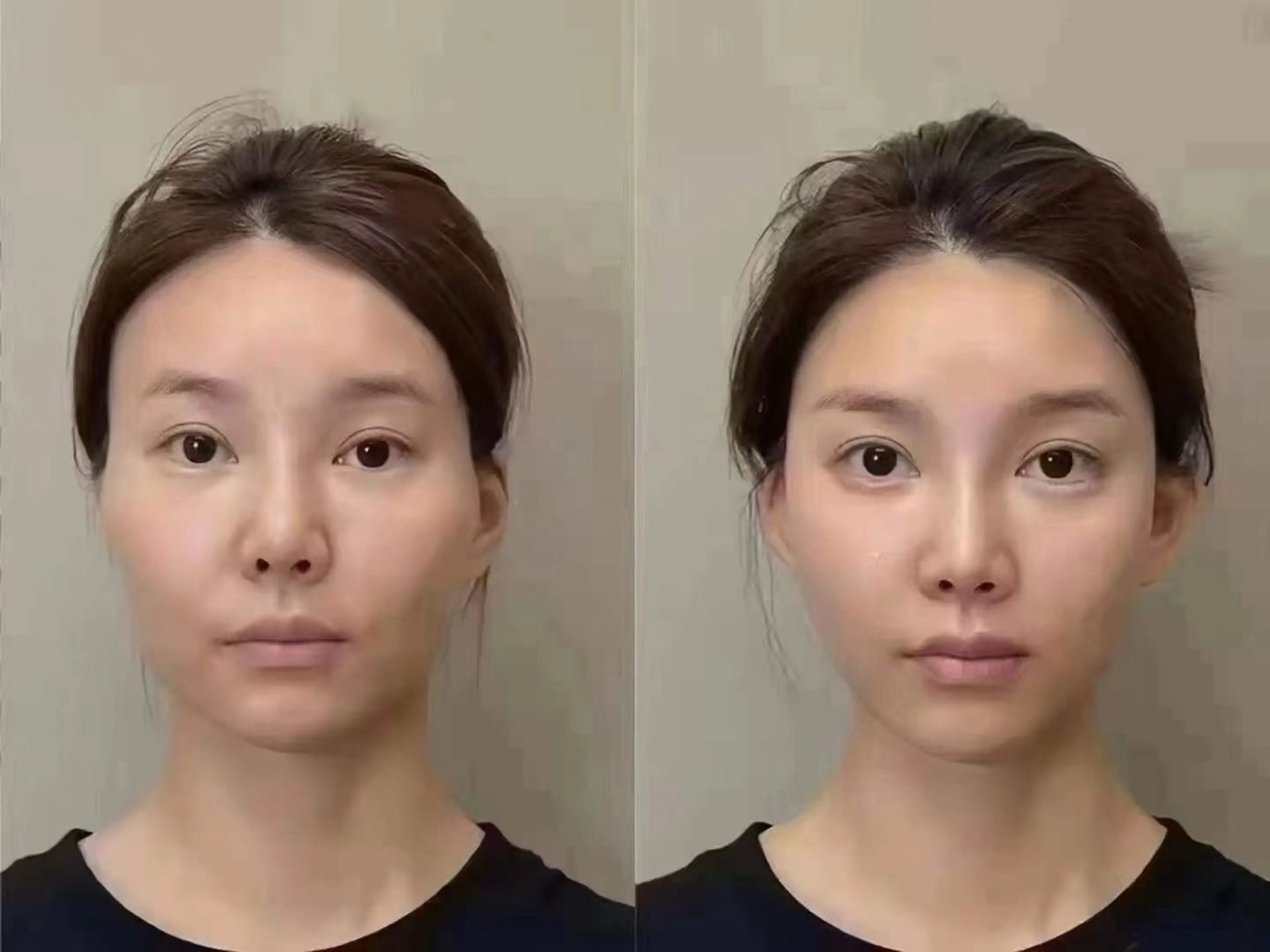 ネイル 韓国ネイル エステ aliaハイフ&水光ジェットサロン所属・aliaハーブ水光店 エステティシャン募集のエステ・リラクイメージ