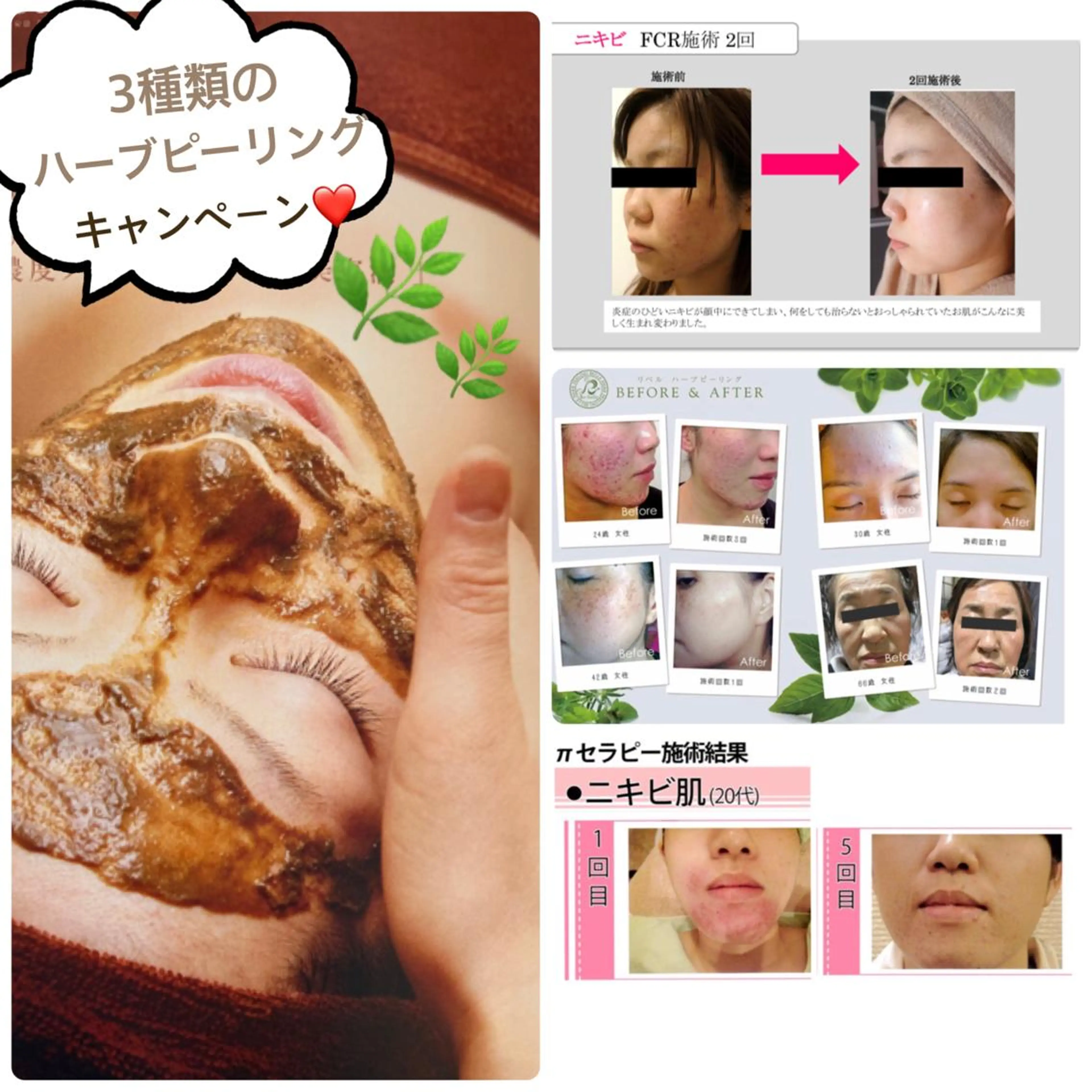 FLEUR大阪・整体 ・ハイフ・痩身・小顔のエステ・リラクイメージ