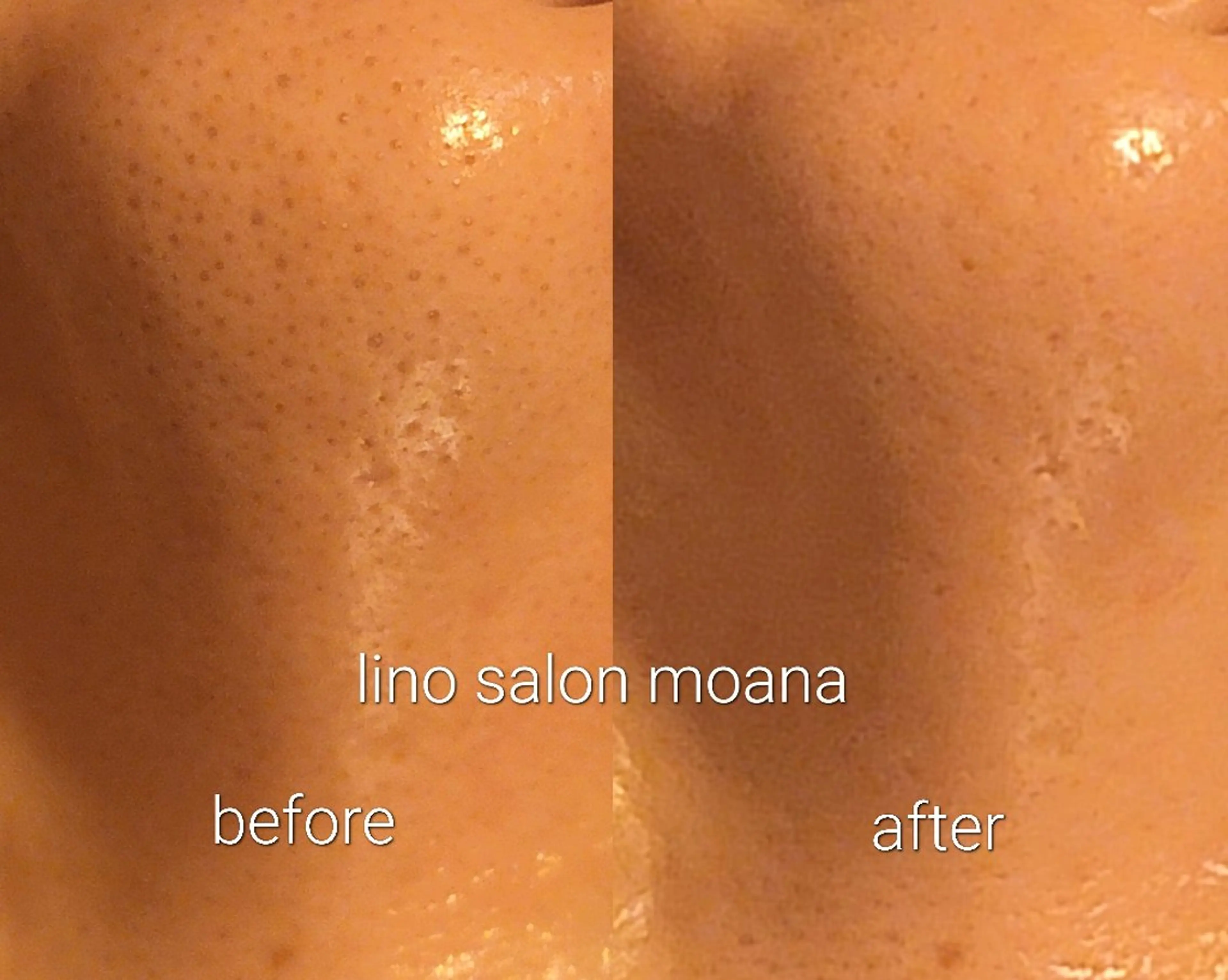 lino salon moana所属・lino salon  moanaのエステ・リラクイメージ