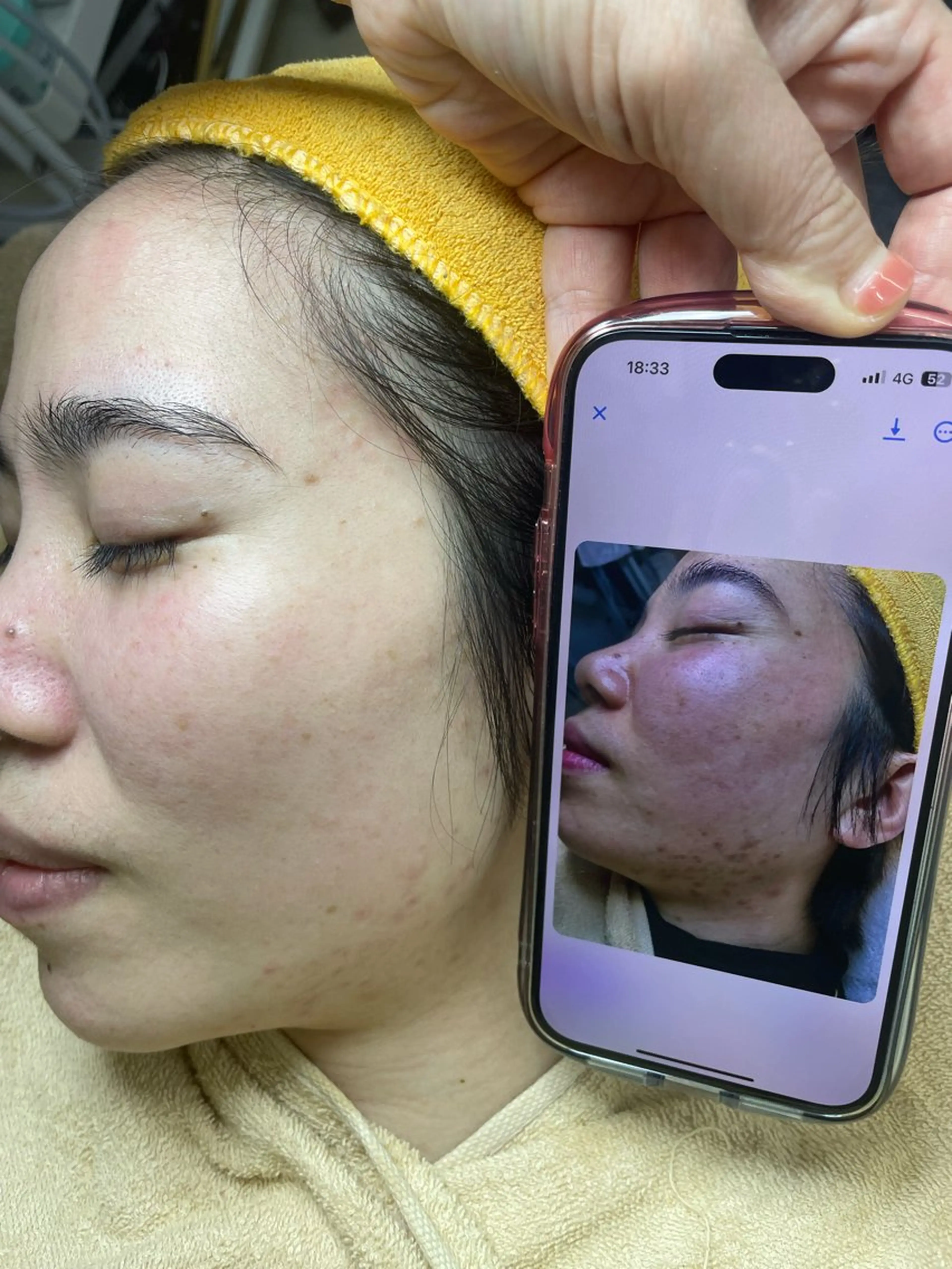 ニキビ、痩身、脱毛、 サクラチャンスパのエステ・リラクイメージ