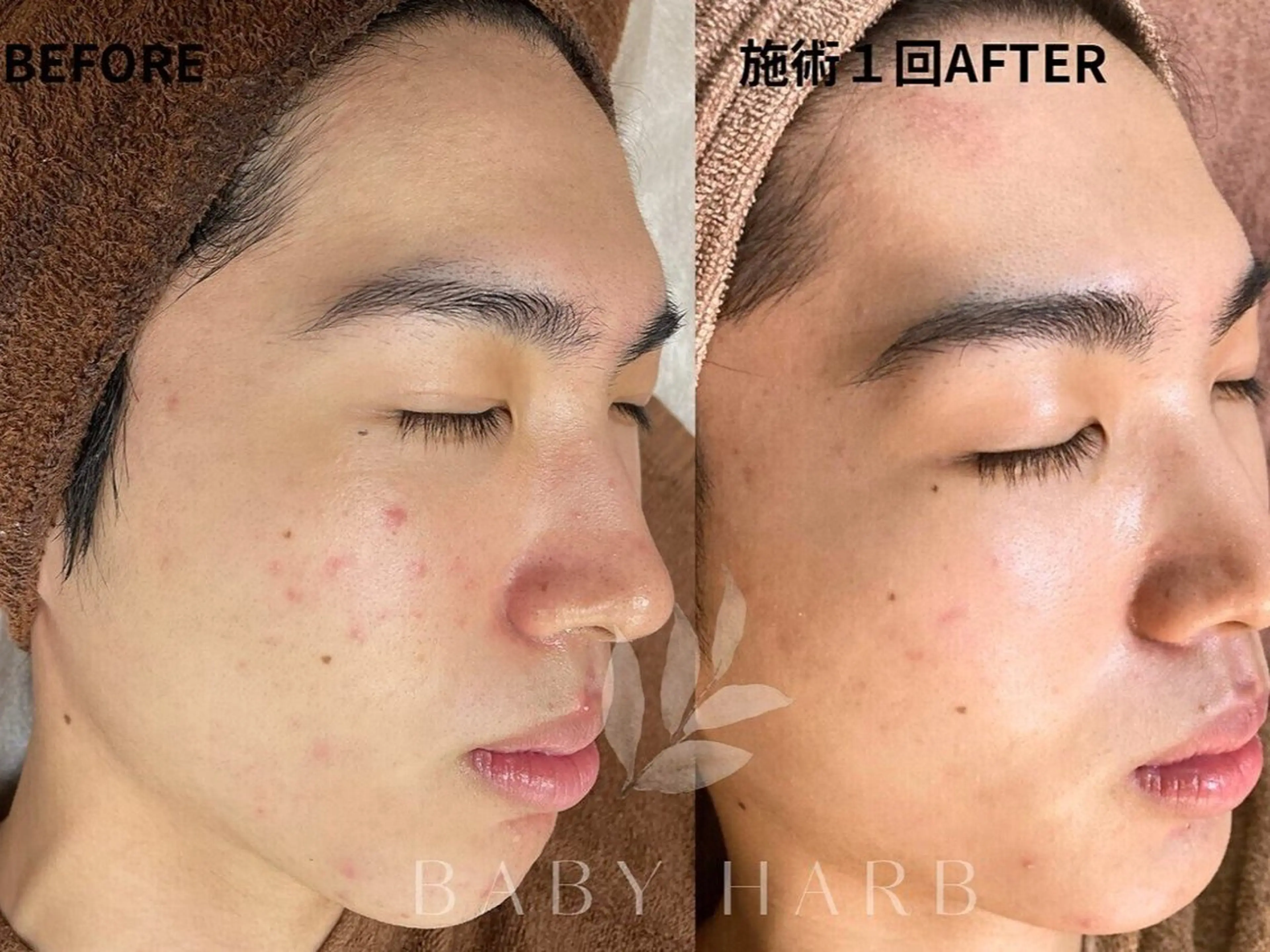 エステ 脱毛サロン&ハーブピーリングFIS戸塚店所属・西内 【FIS】のエステ・リラクイメージ