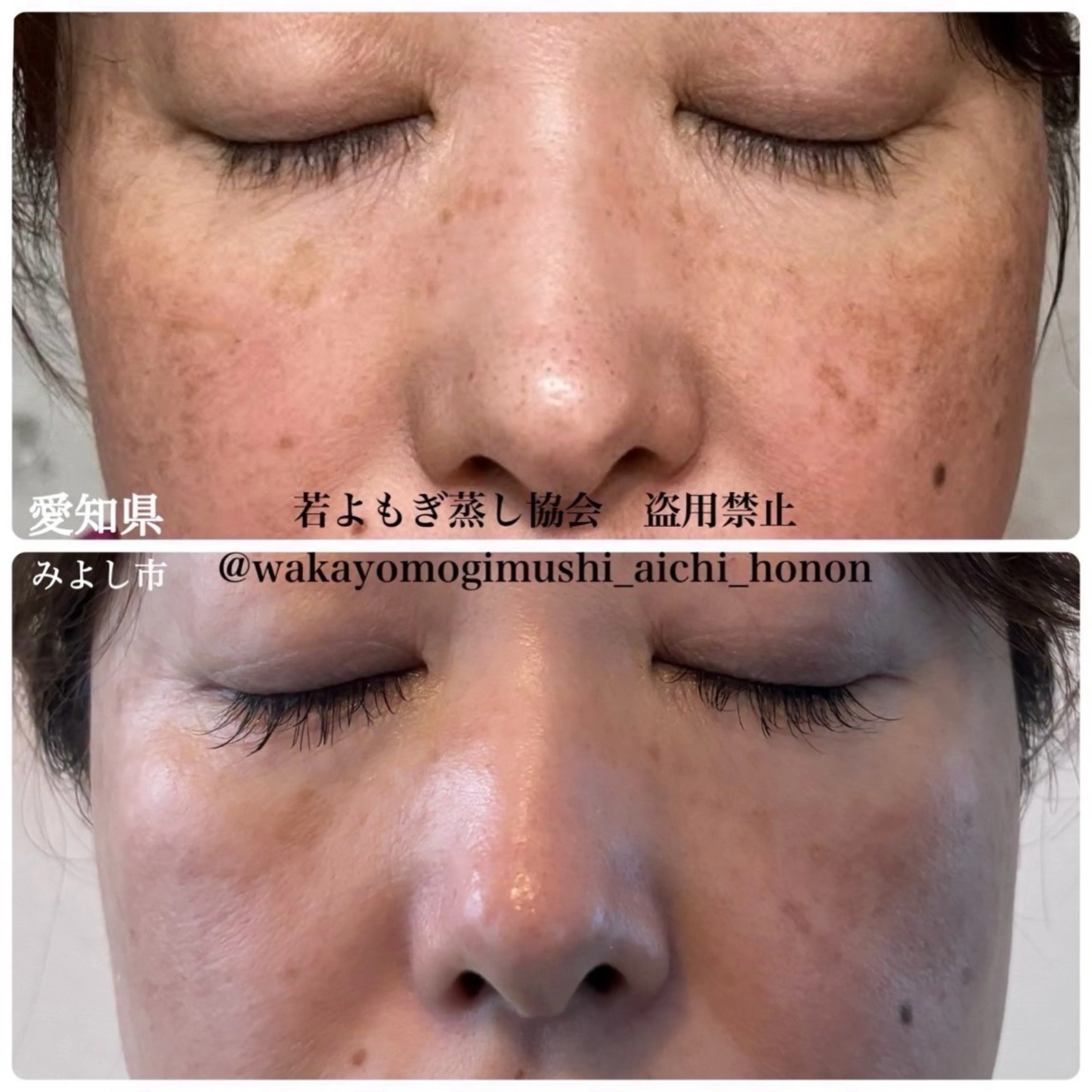 private salon Dea_maris シュガーリング&パーソナルボディケア所属・シミ改善・韓国肌管理 ボディメイク痩身のその他イメージ