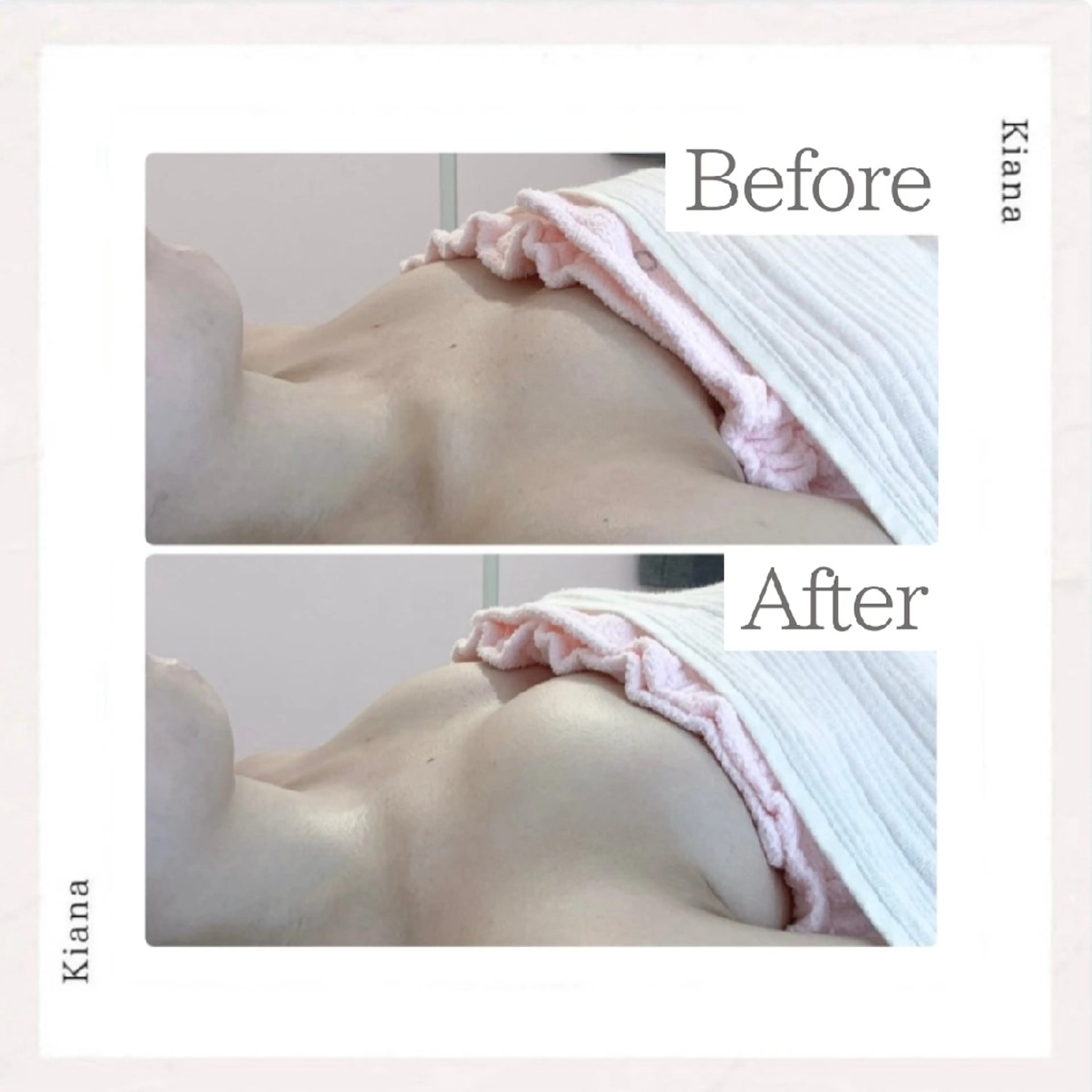 【バスト専門店 】 Kiana のエステ・リラクイメージ