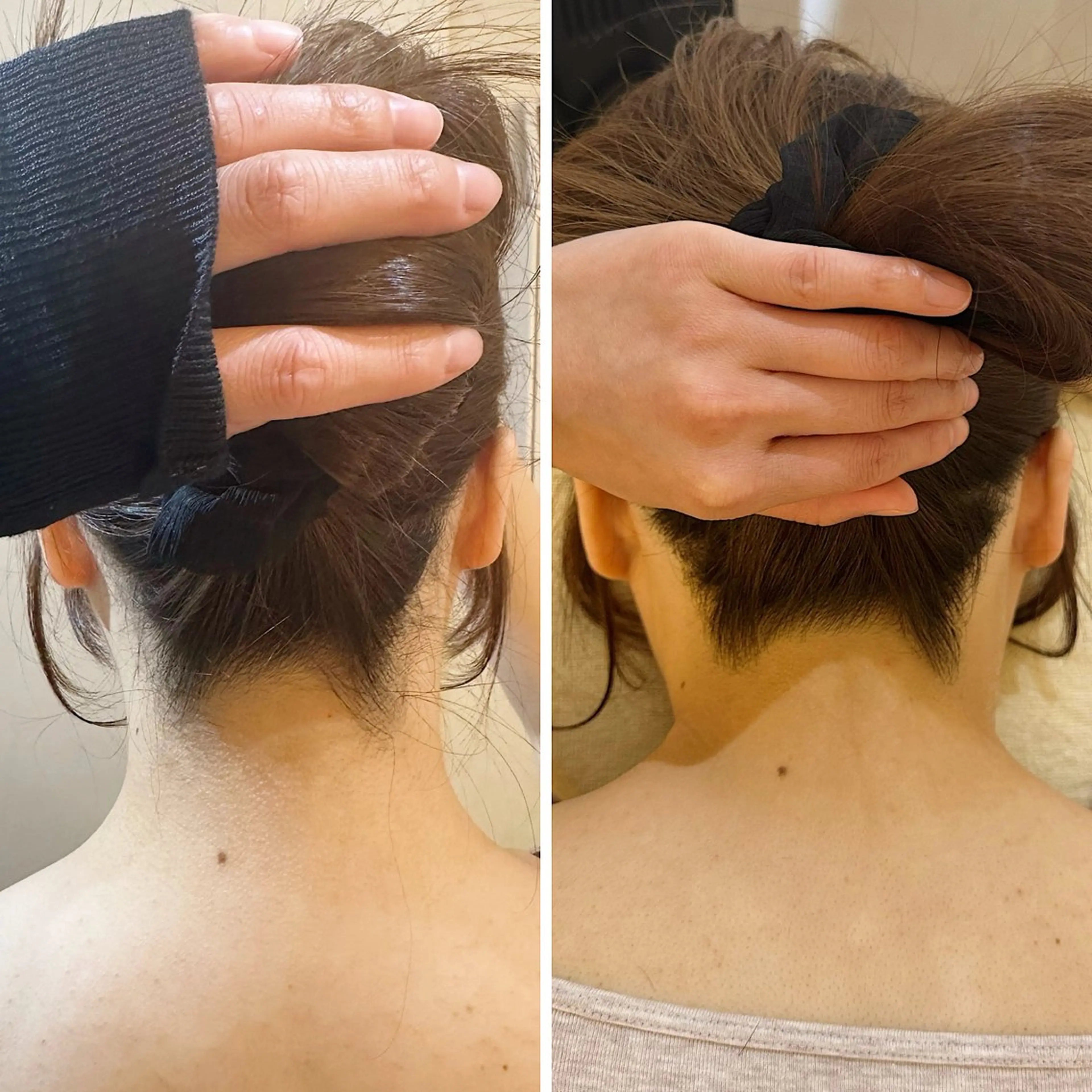 脱毛 うなじ脱毛/美肌脱毛 LABELのエステ・リラクイメージ