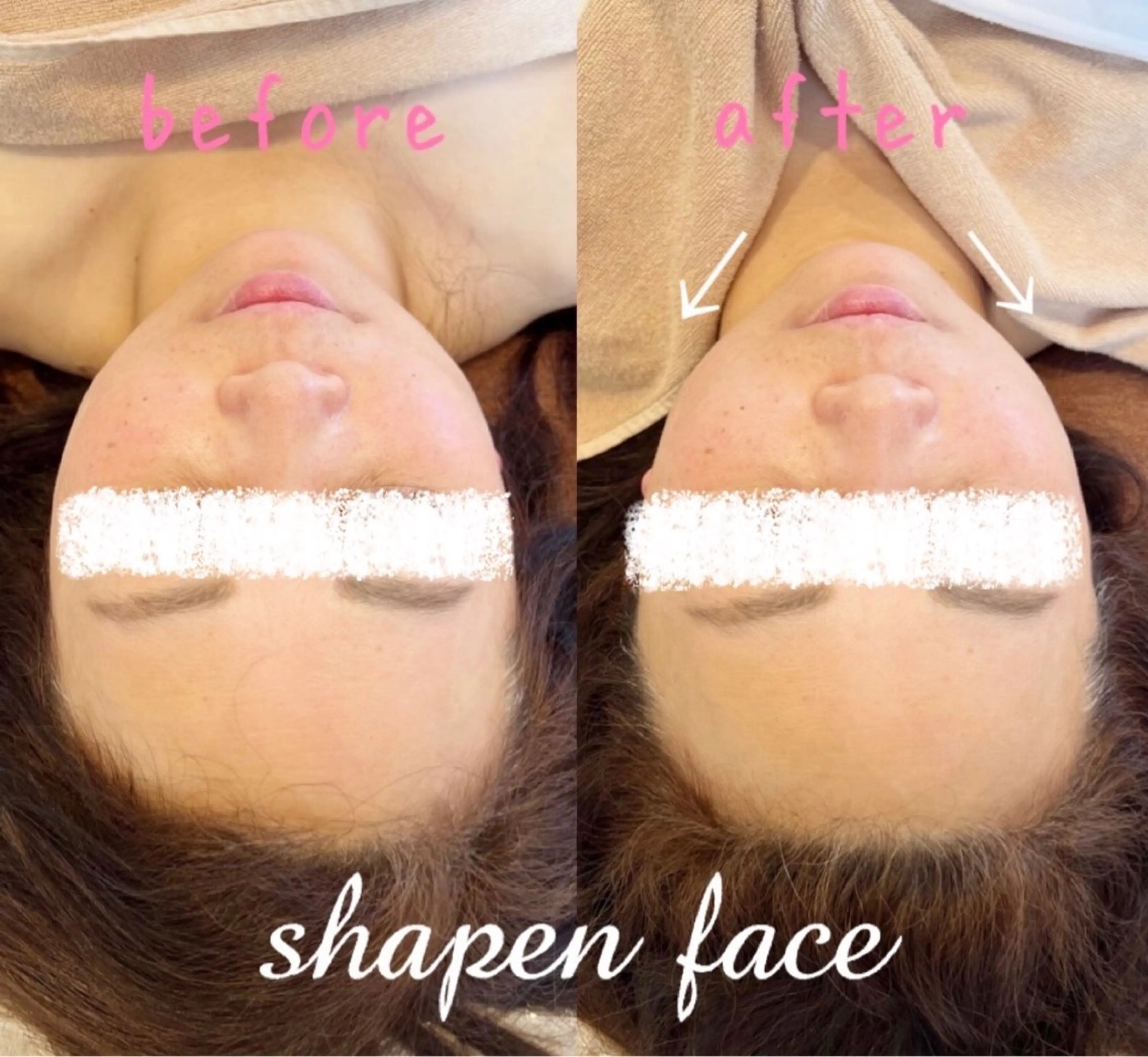 【小顔矯正＋ヘッド】《大口式シャープンフェイス》で自分史上最小の小顔を目指す☆頭のカタチも小さく丸く♪/自律神経整えケアの写真