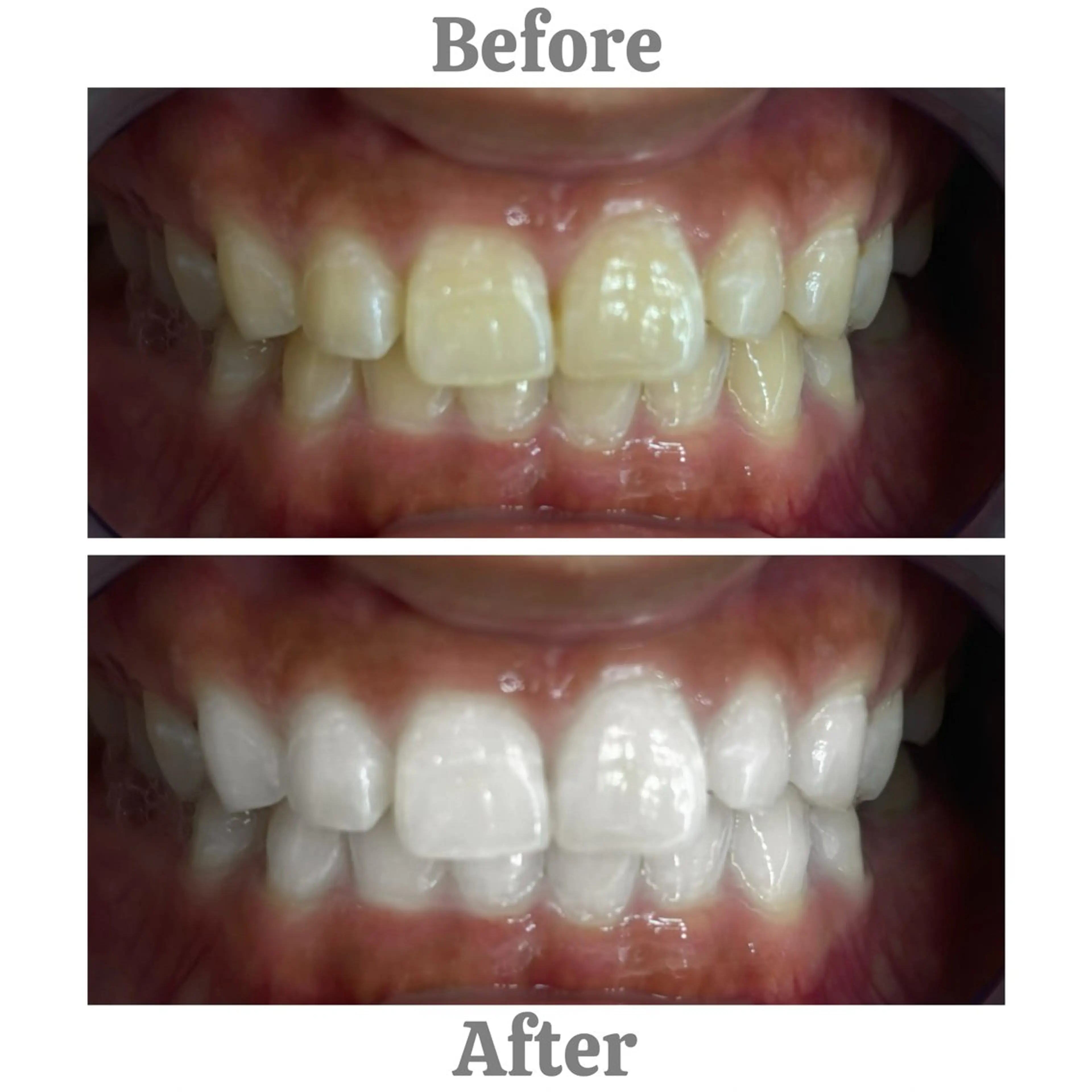 セルフホワイトニング　エクシア相模大野店所属・セルフホワイトニング エクシア相模大野店のその他イメージ