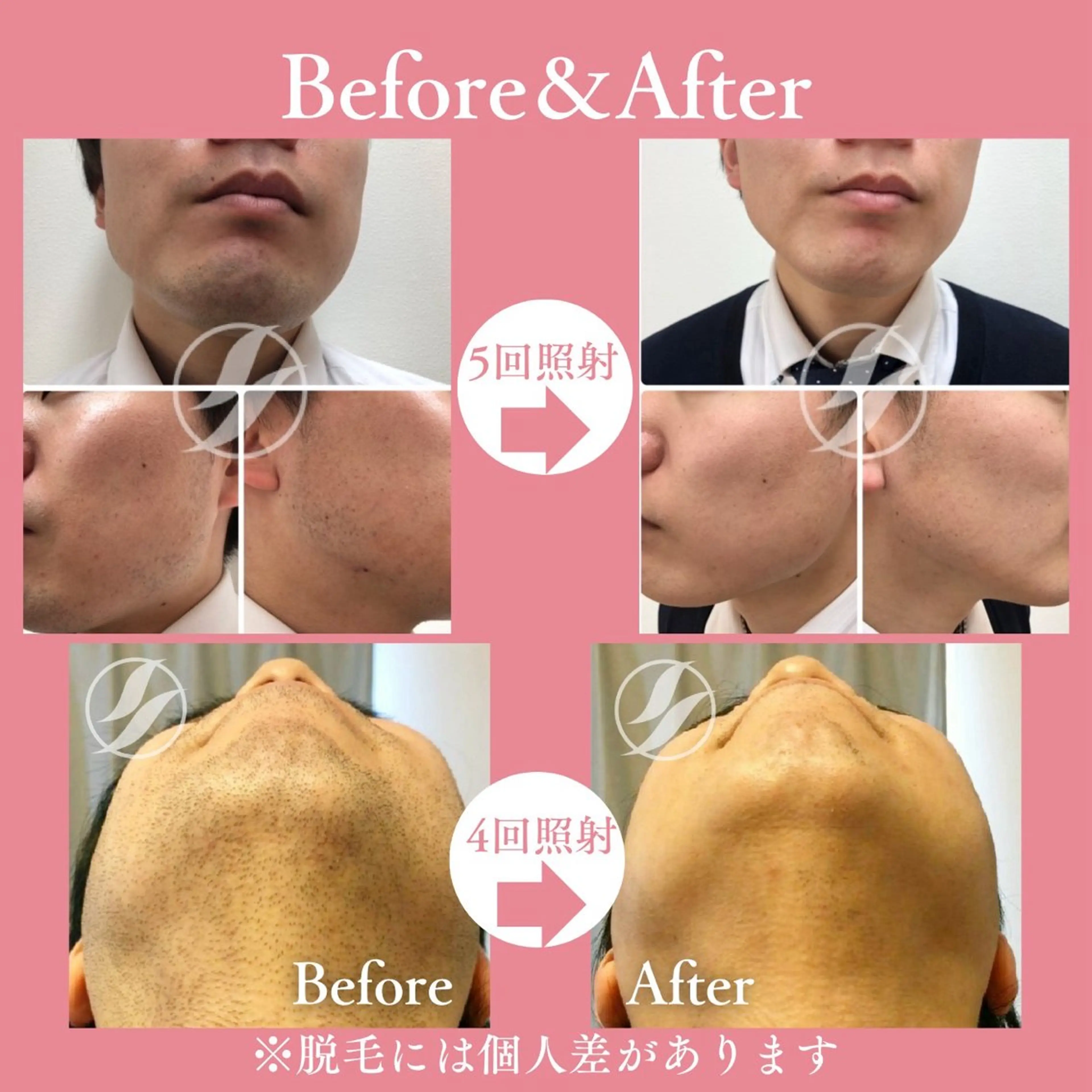 メンズ 有人型セルフサロン 脱毛／痩身／美顔のその他イメージ