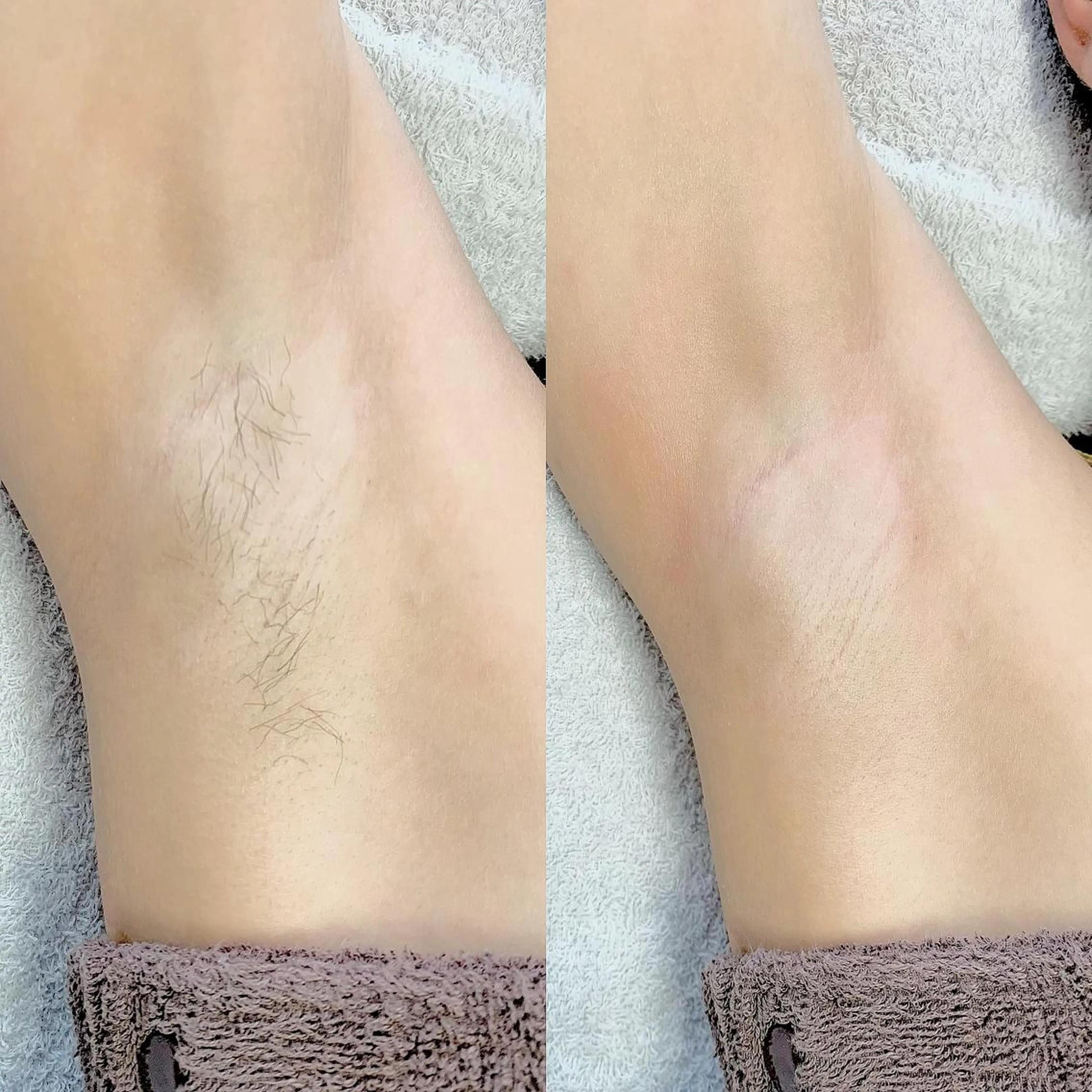 メンズ 脱毛 salonLADYSTYLE所属・稲嶺 美華のエステ・リラクイメージ
