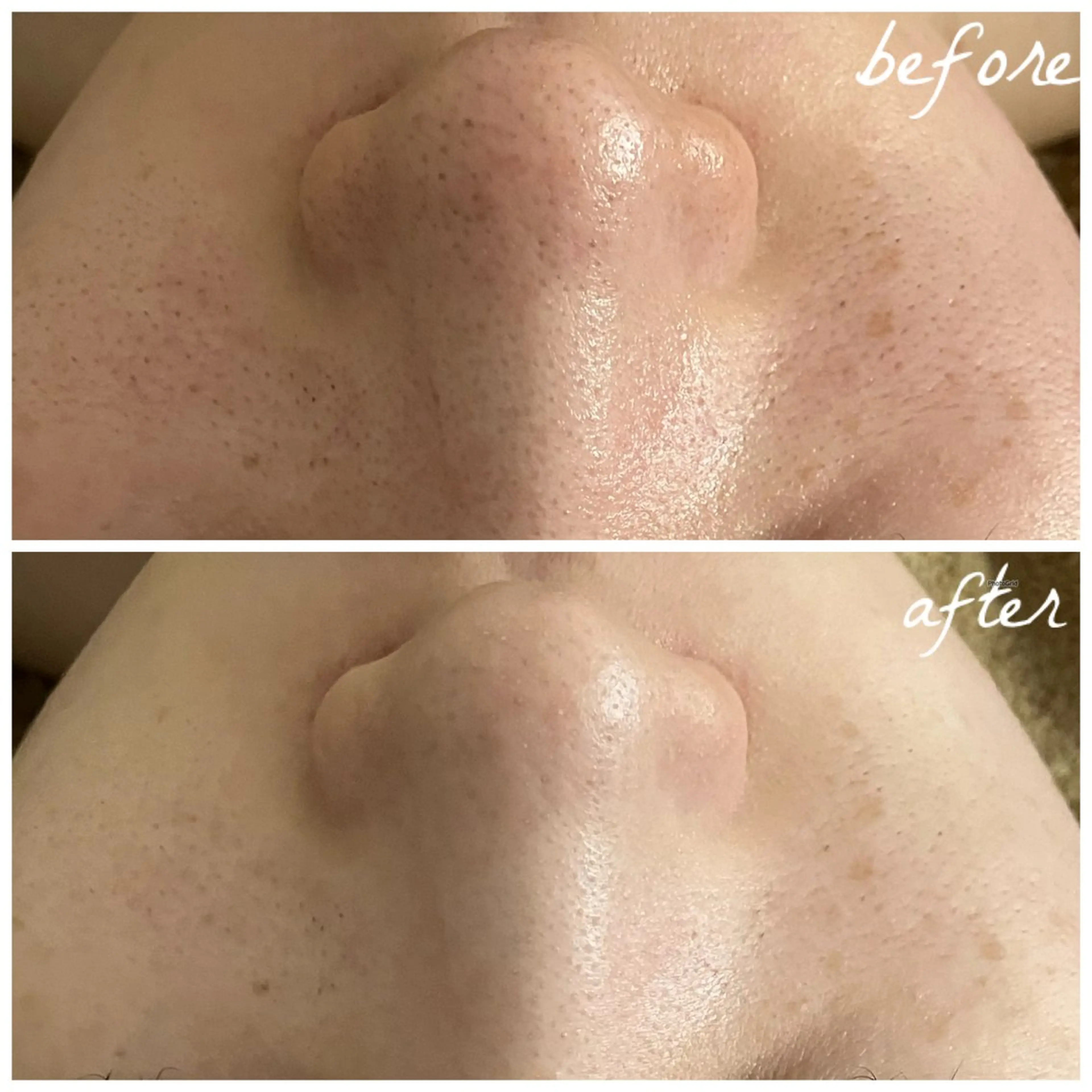 メンズ メナード岐阜茜部 杉浦のエステ・リラクイメージ