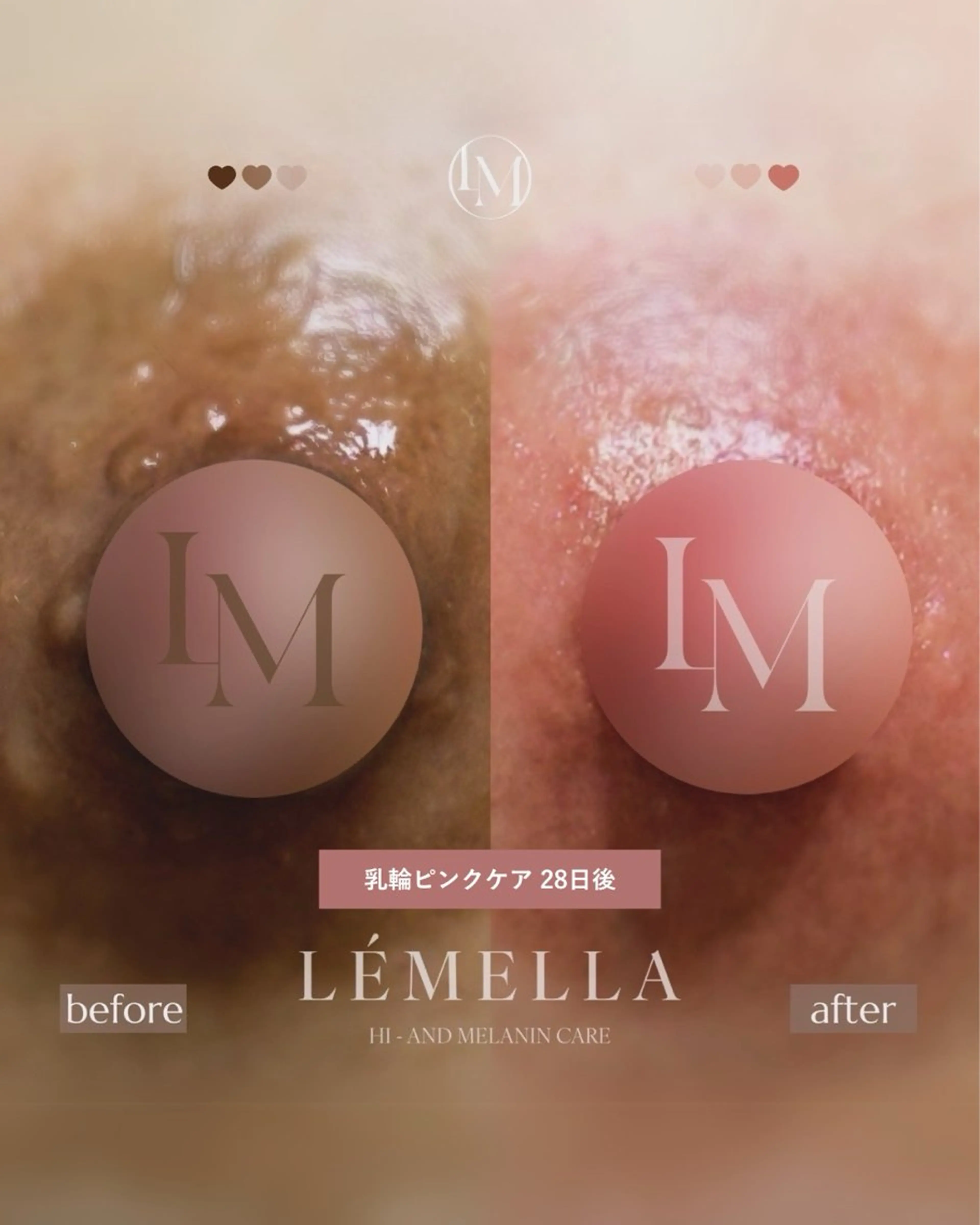 NAIL＆EYELASH SALON Lovers MOMO ～ラヴァーズ モモ～所属・Lovers MOMOのエステ・リラクイメージ