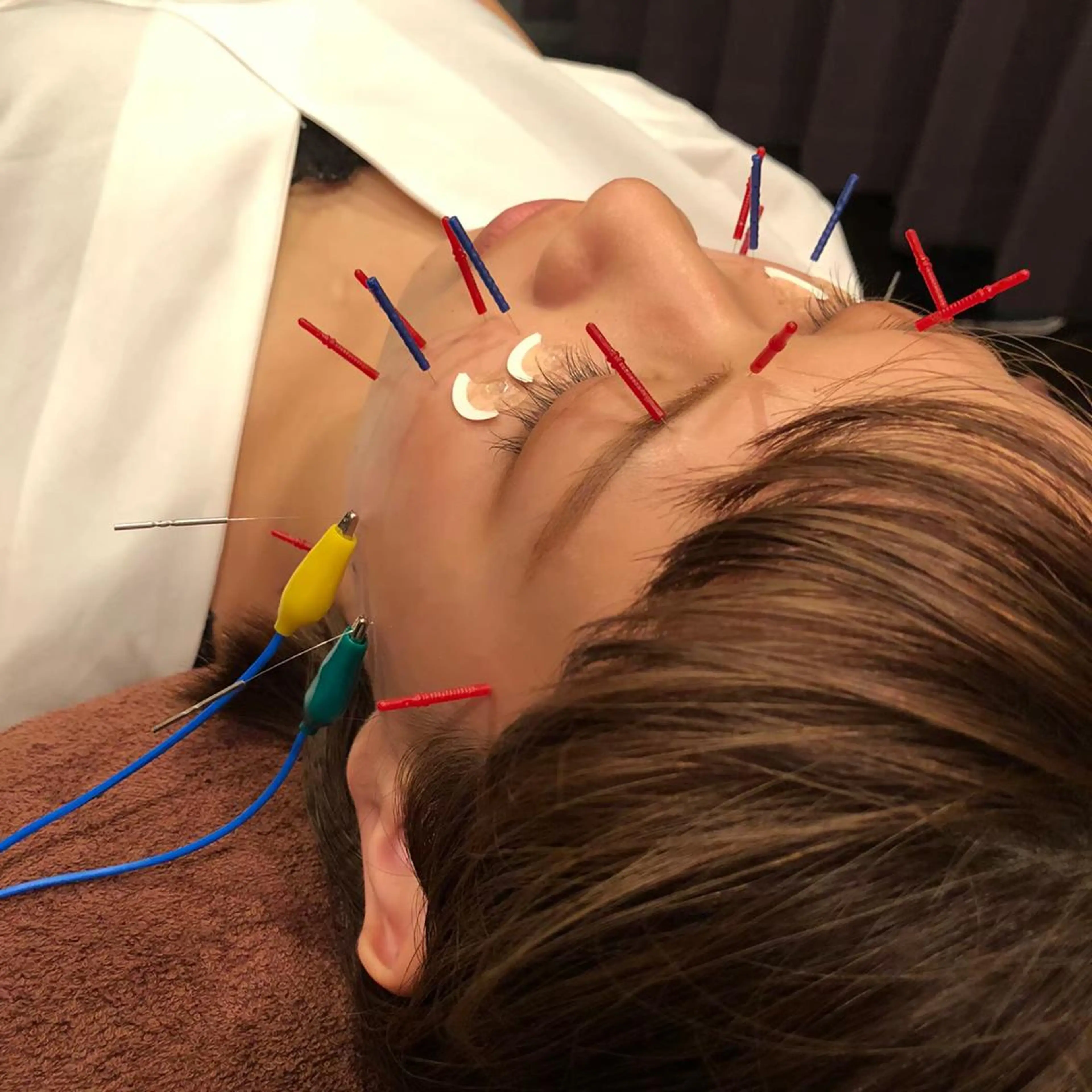 小林整骨院玉川 キジマのエステ・リラクイメージ