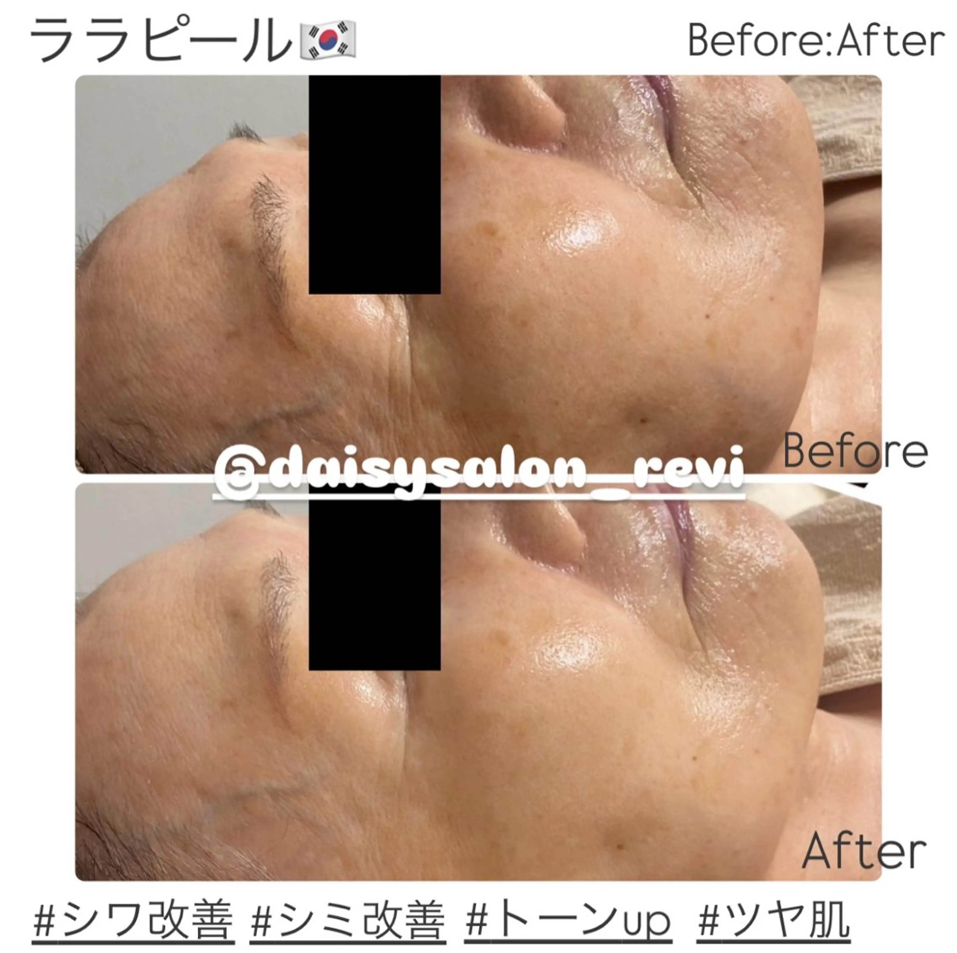 初回限定 ララピール🇰🇷 専用パック付きの写真