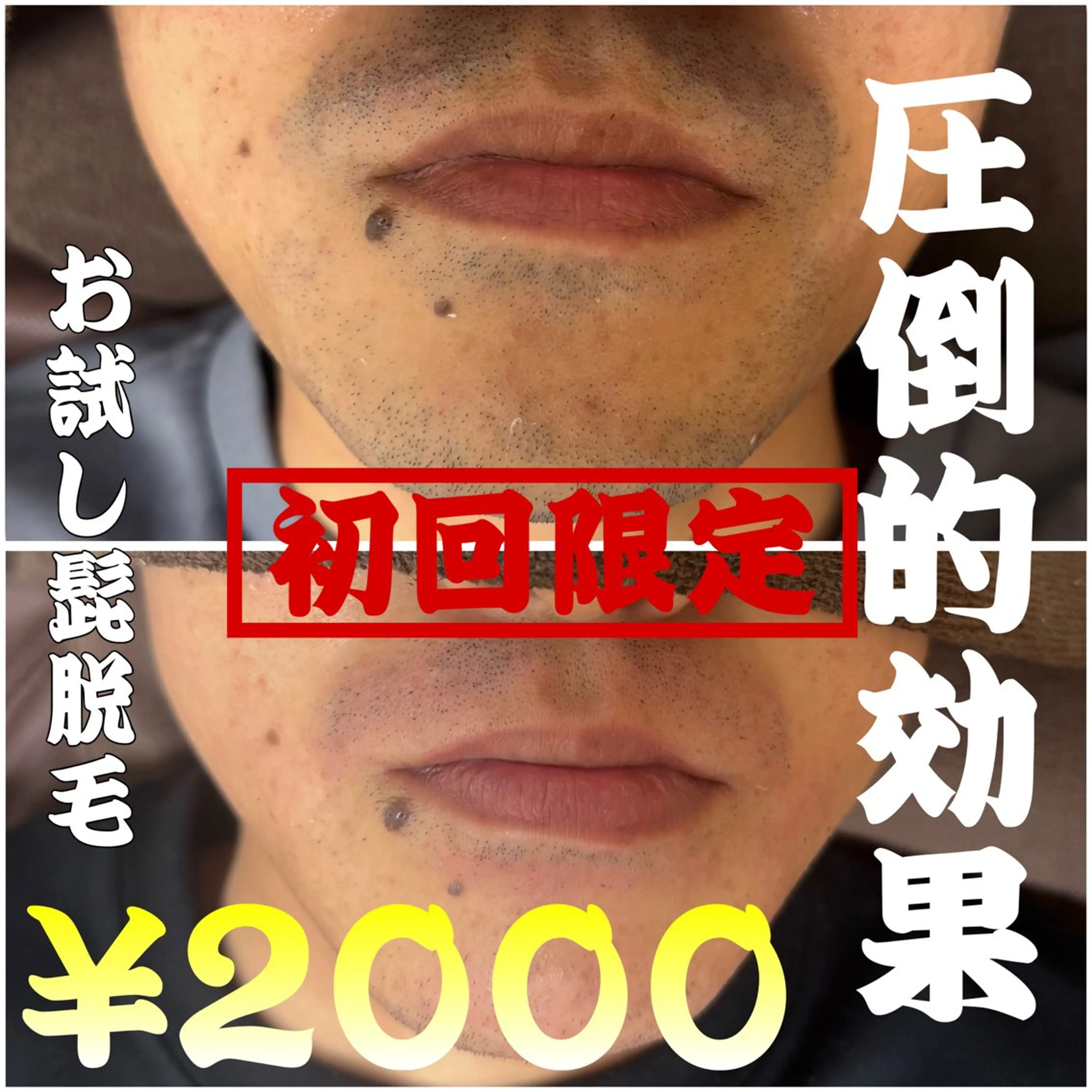 メンズ 脱毛 菊池 雪乃のエステ・リラクイメージ