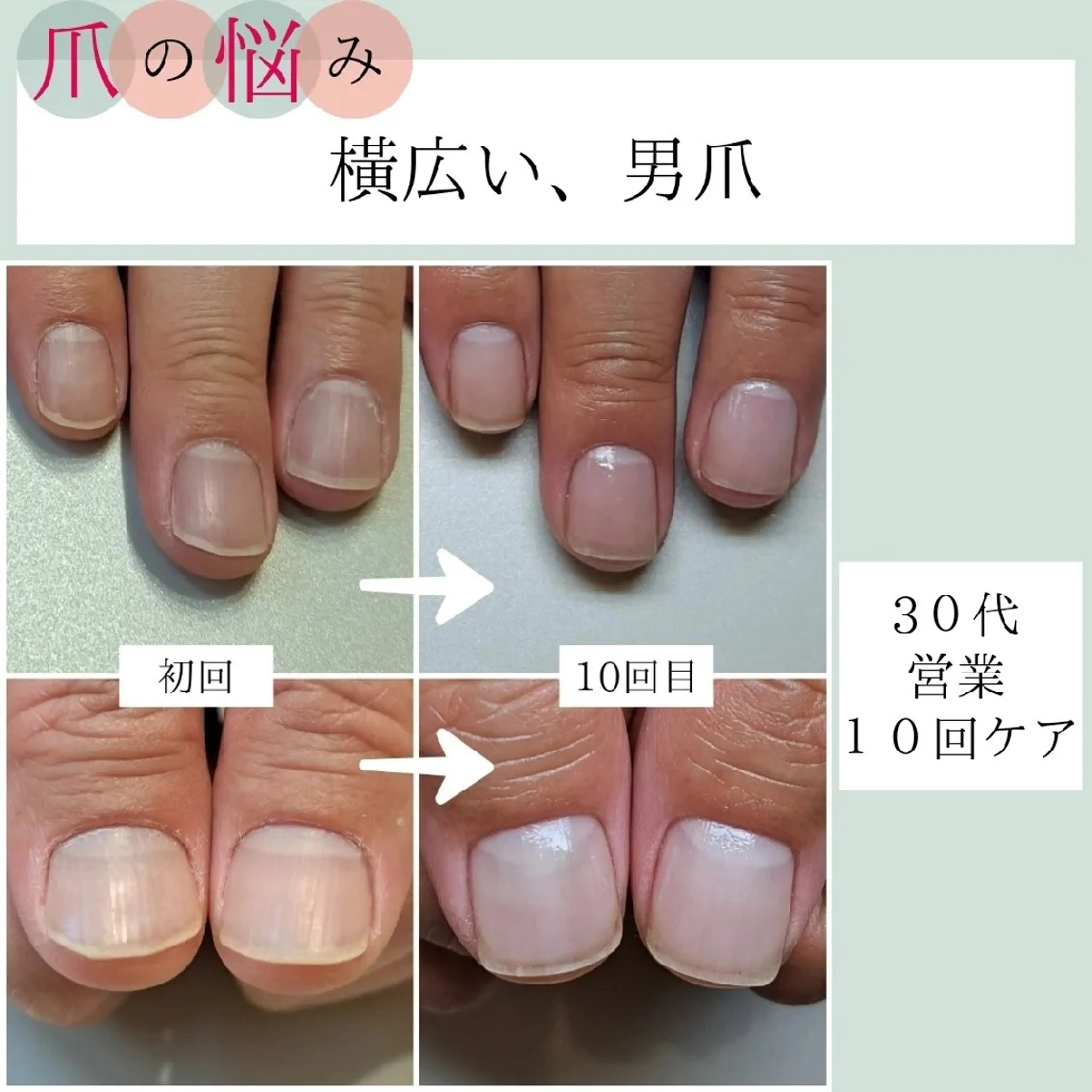 ネイル ハンドケア AKT NAIL所属・AKT Beauty ドライヘッドスパのネイルデザイン