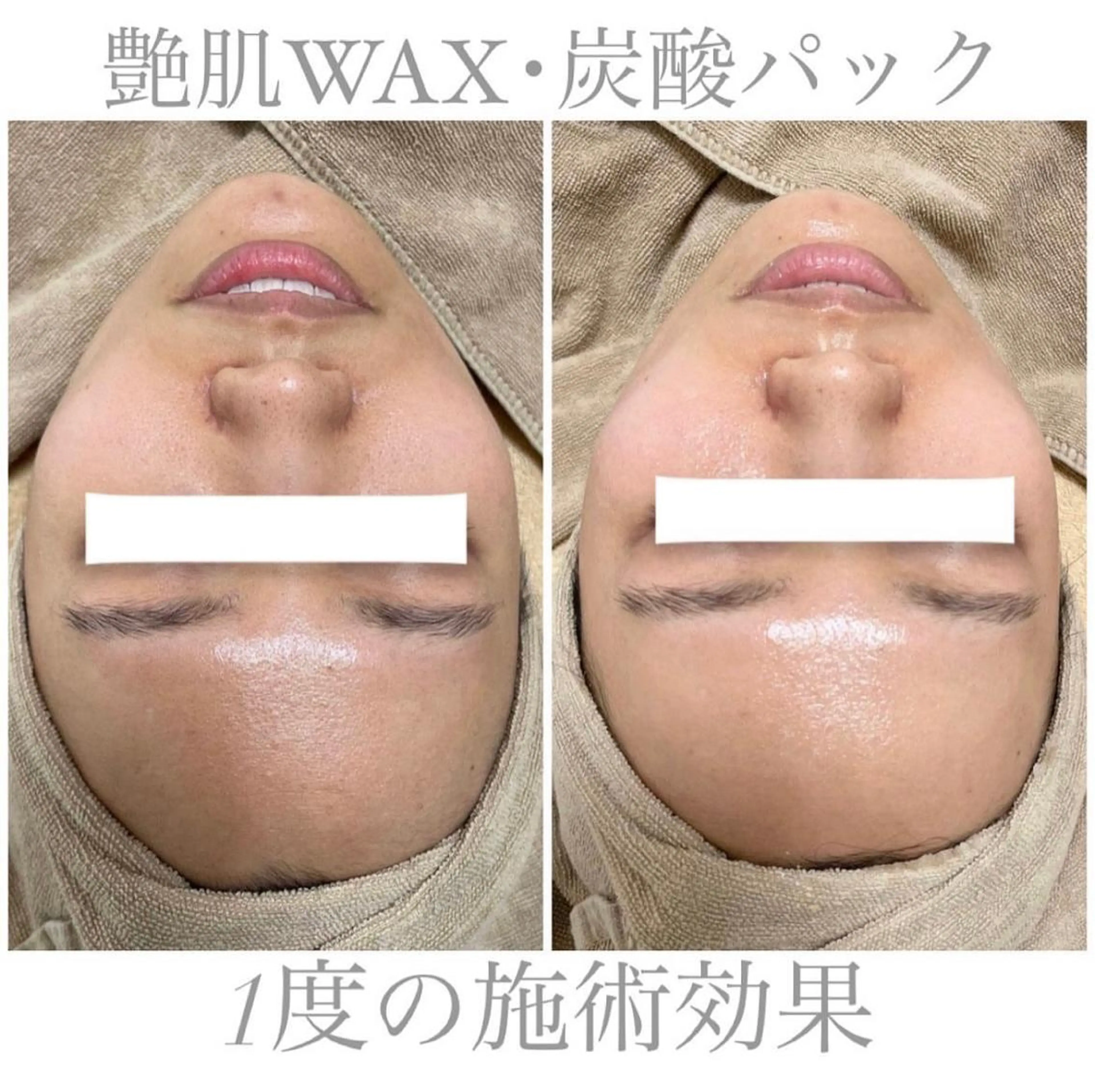 脱毛 エステサロン Mi-mi.iのエステ・リラクイメージ