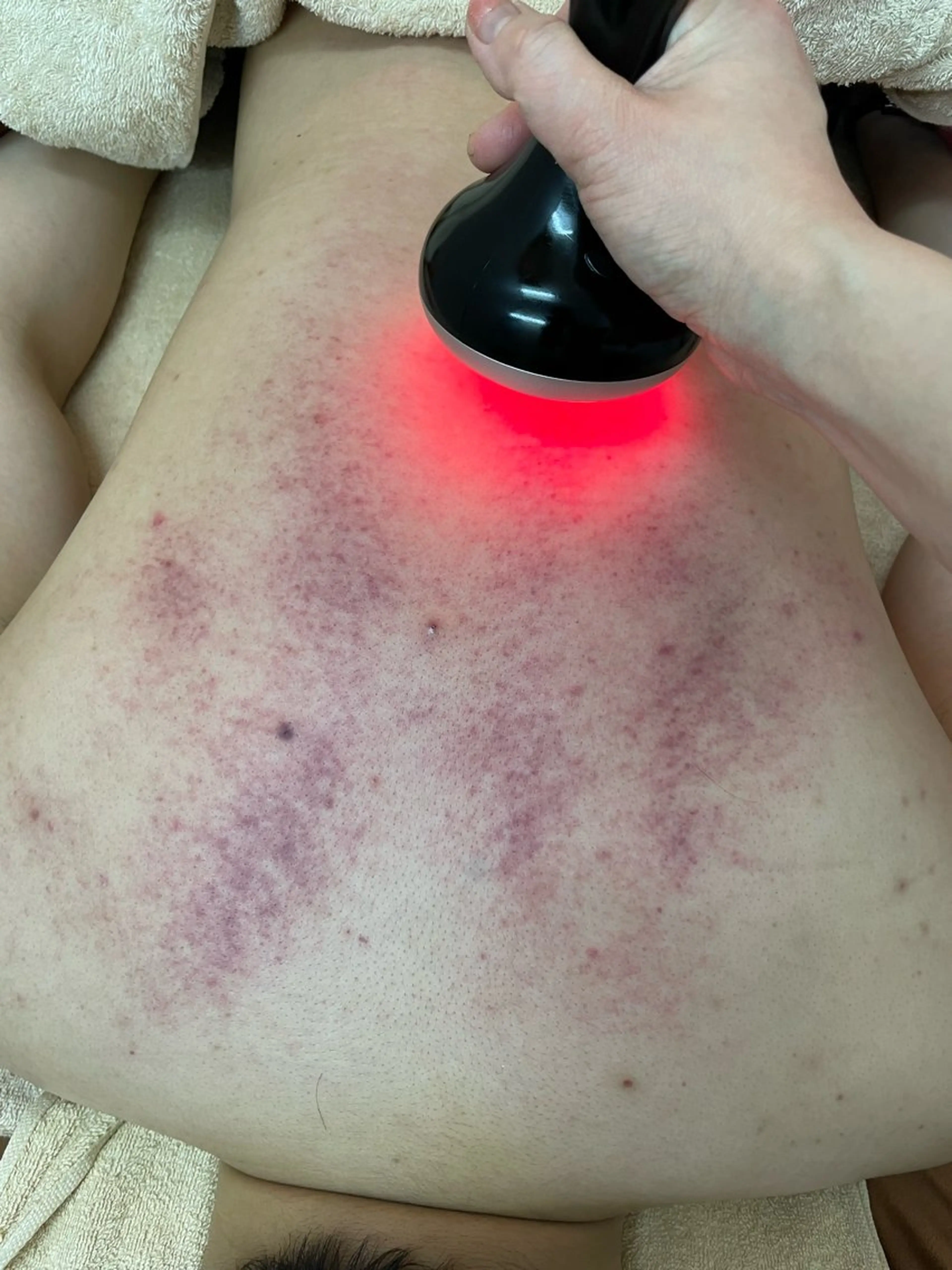 エステ ニキビ、痩身、脱毛、 サクラチャンスパのエステ・リラクイメージ